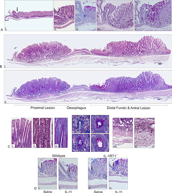 Microscopic analysis of pathology in 12 week old gp130757FF xIL-1RT1&#x2013;/&#x2013; mice and in WT and IL-1RT1&#x2013;/&#x2013; mice administered with IL-11 for 7 days.