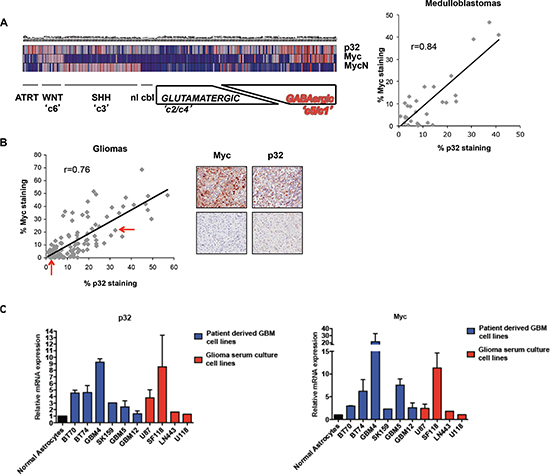 Correlation between p32 and Myc expression in human gliomas and glioma cell lines.