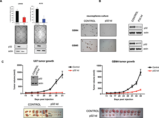 Attenuation of p32 expression reduces glioma cell proliferation and tumor growth.