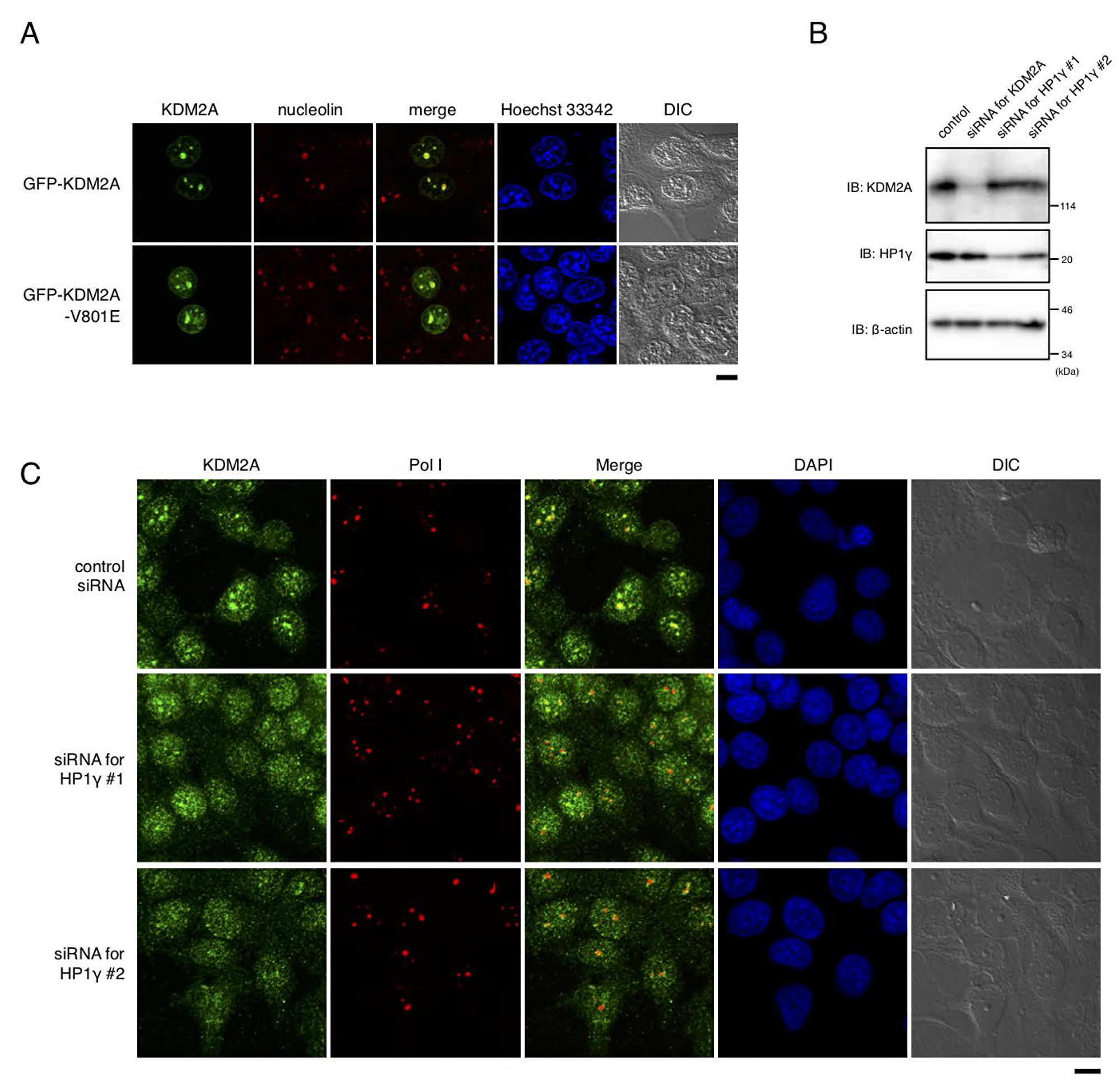 HP1γ is involved in nucleolar accumulation and binding to rDNA promoter of KDM2A.