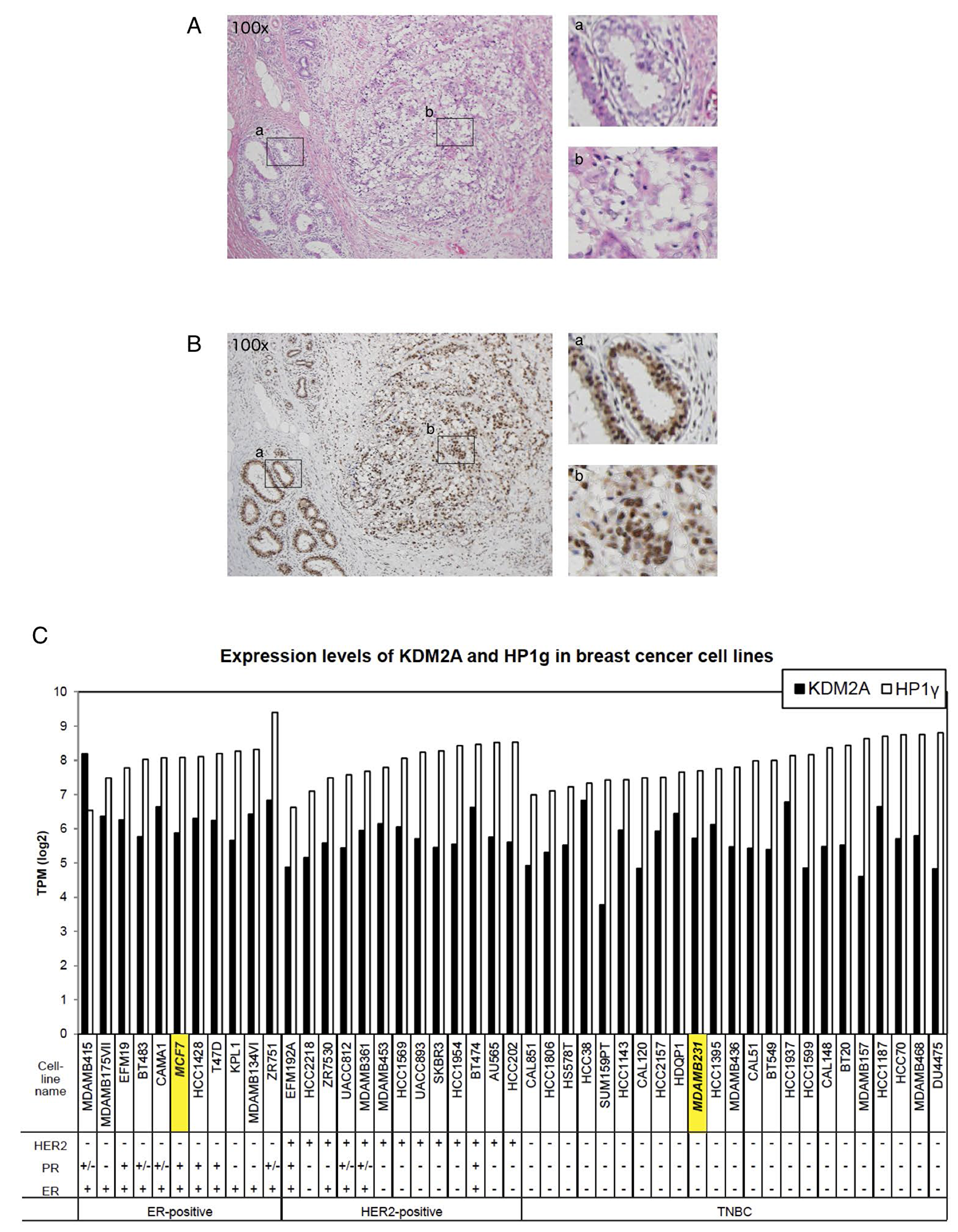 HP1γ expression is maintained in breast cancer tissues.