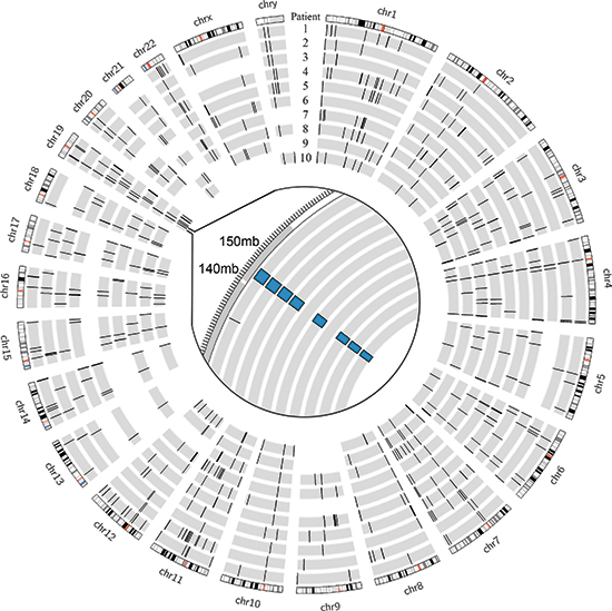 Genomic deletions in FL-HCC across 10 patients.