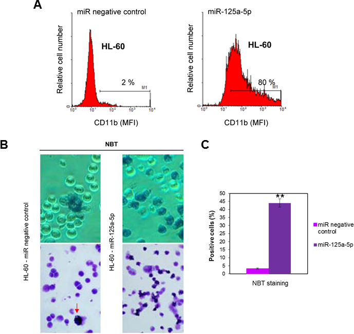 Ectopic expression of miR-125-a-5p promotes granulocytic cell differentiation of human myeloid leukemia HL-60 cell line.