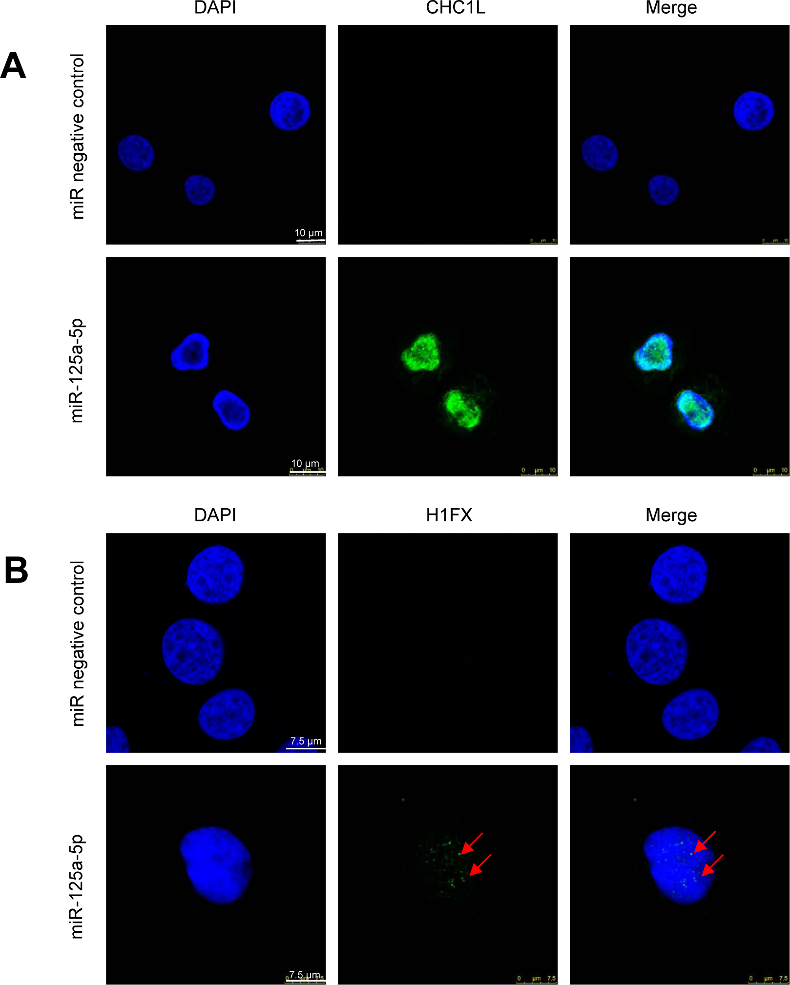 Confocal microscopy for the expression of CHCL1 and H1FX in HL-60 cells following miR-125a-5p ectopic expression.