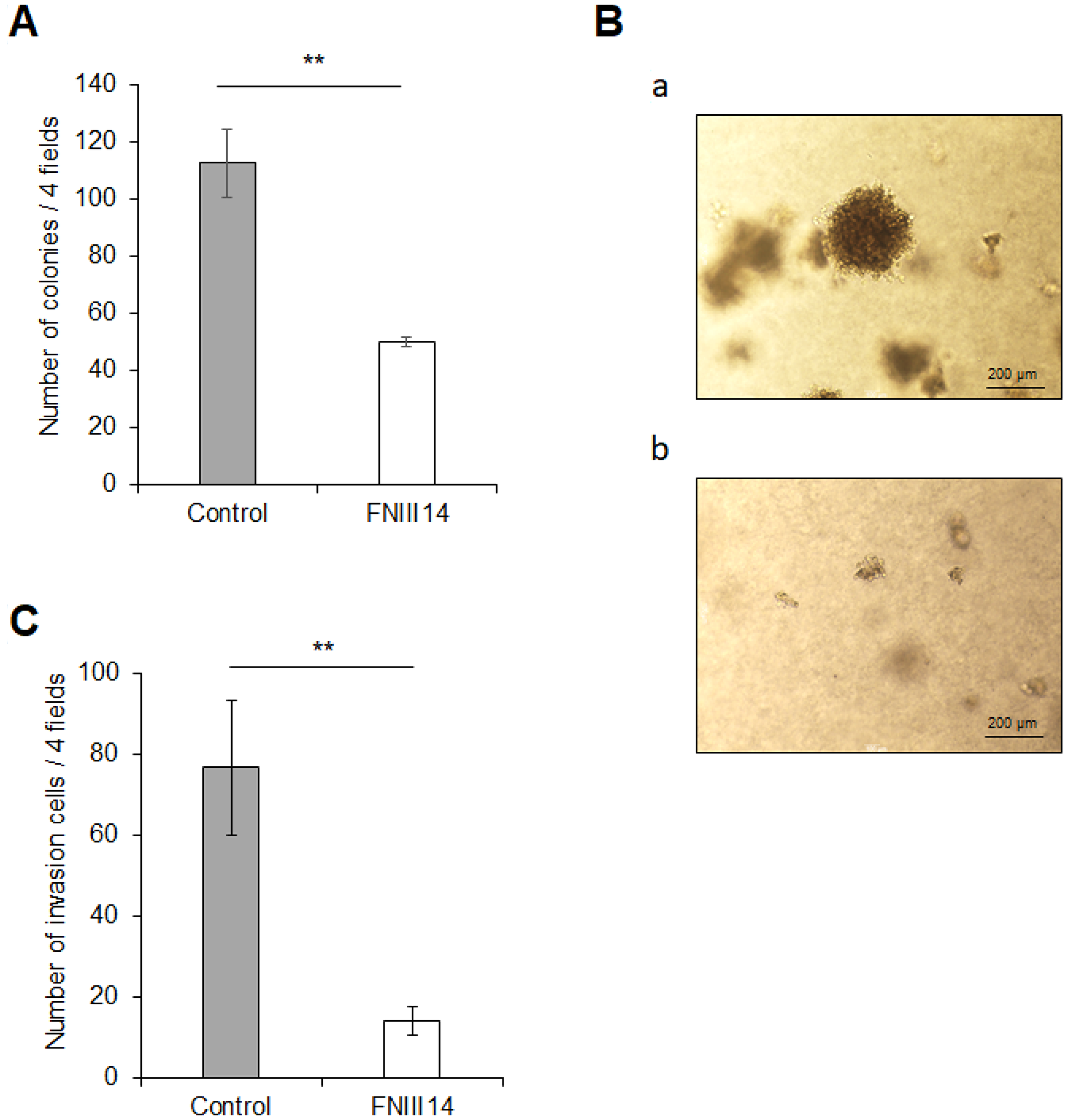 FNIII14 has the ability to attenuate cancer-related malignant properties.