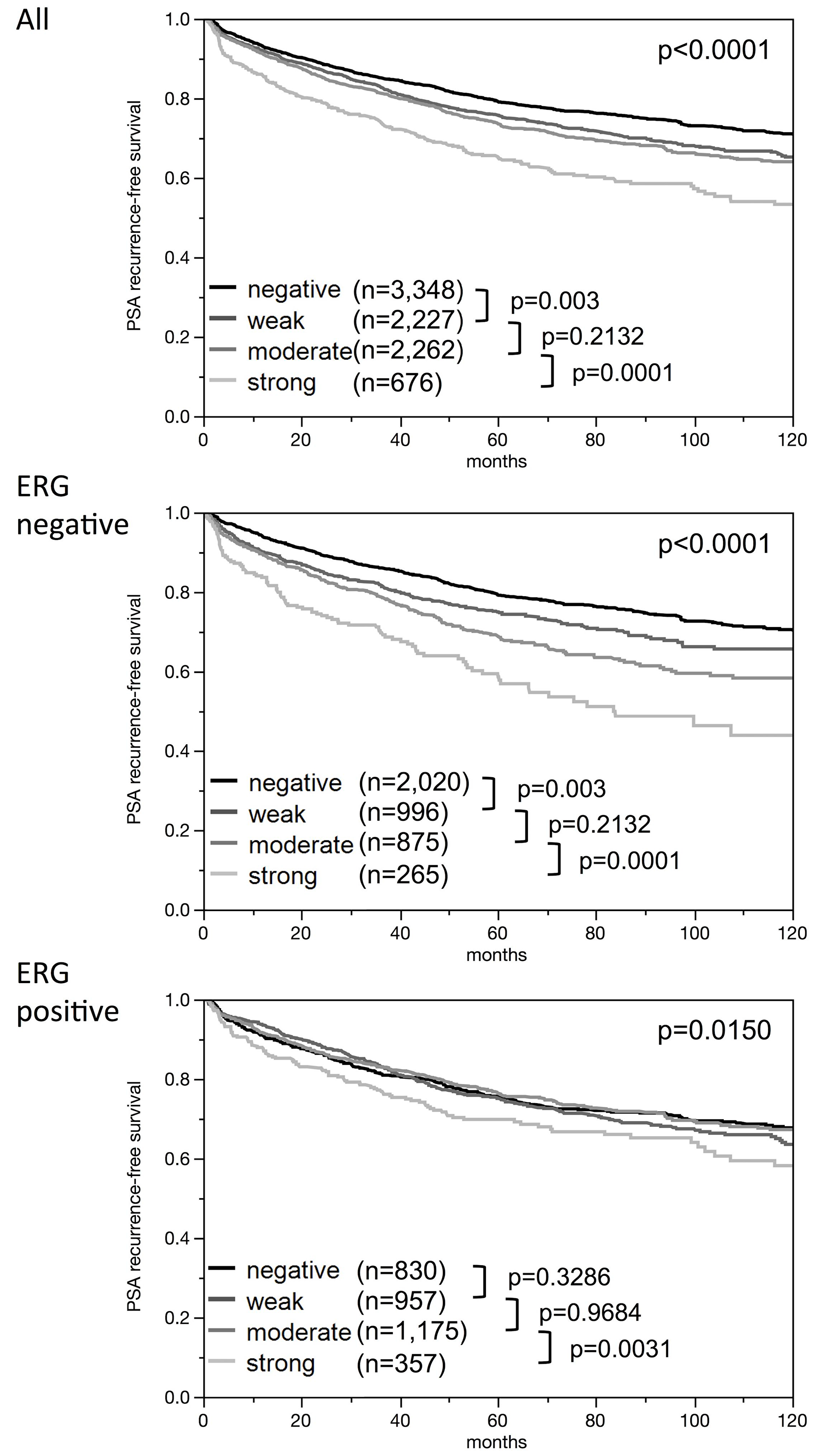 Kaplan-Meier plots of prostate specific antigen (PSA) recurrence after radical prostatectomy and ELAC2 staining in all cancers, the ERG negative subset, and the ERG positive subset.