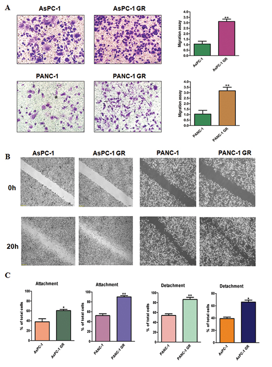 Gemcitabine-resistant (GR) cells have enhanced motility activity.