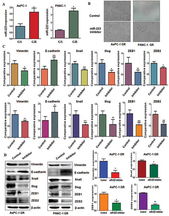 Gemcitabine-resistant (GR) cells have high expression of miR-223.