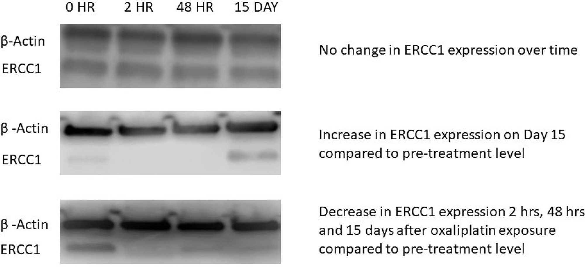 Western blot (WB) images from three representative patients.