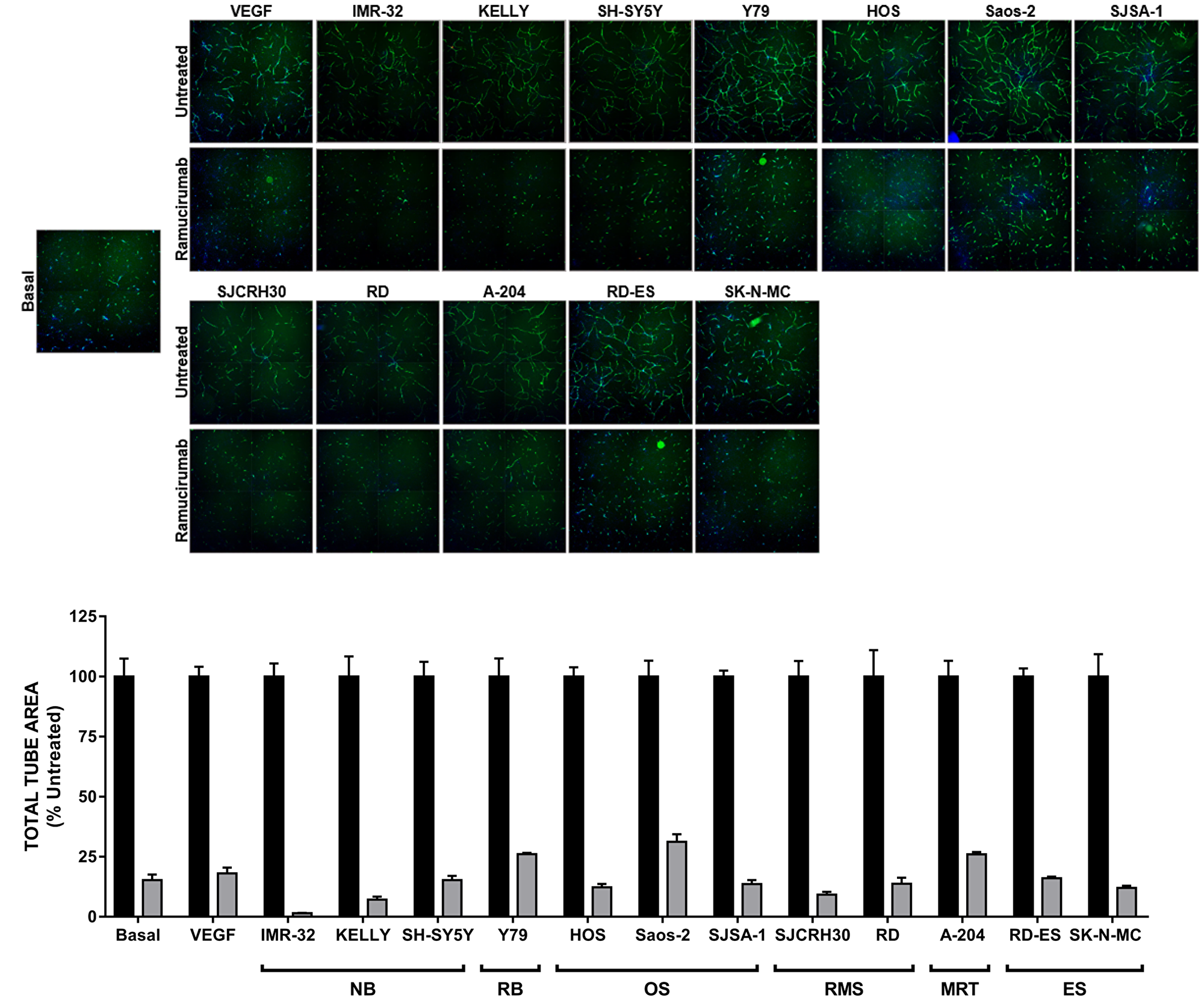 Ramucirumab blocks both VEGF-A- and pediatric tumor cell-driven cord formation in vitro.