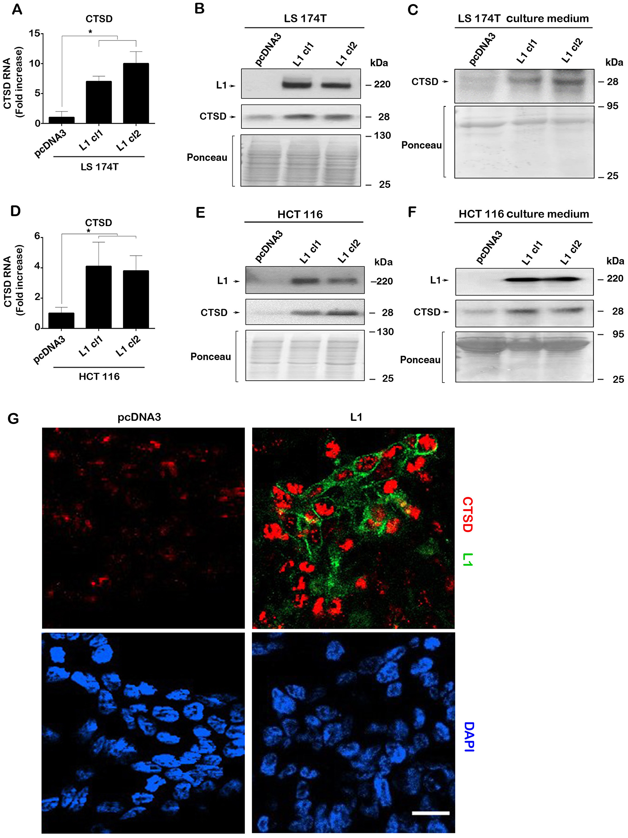 L1 overexpression in human CRC cell lines induces the expression of CTSD.