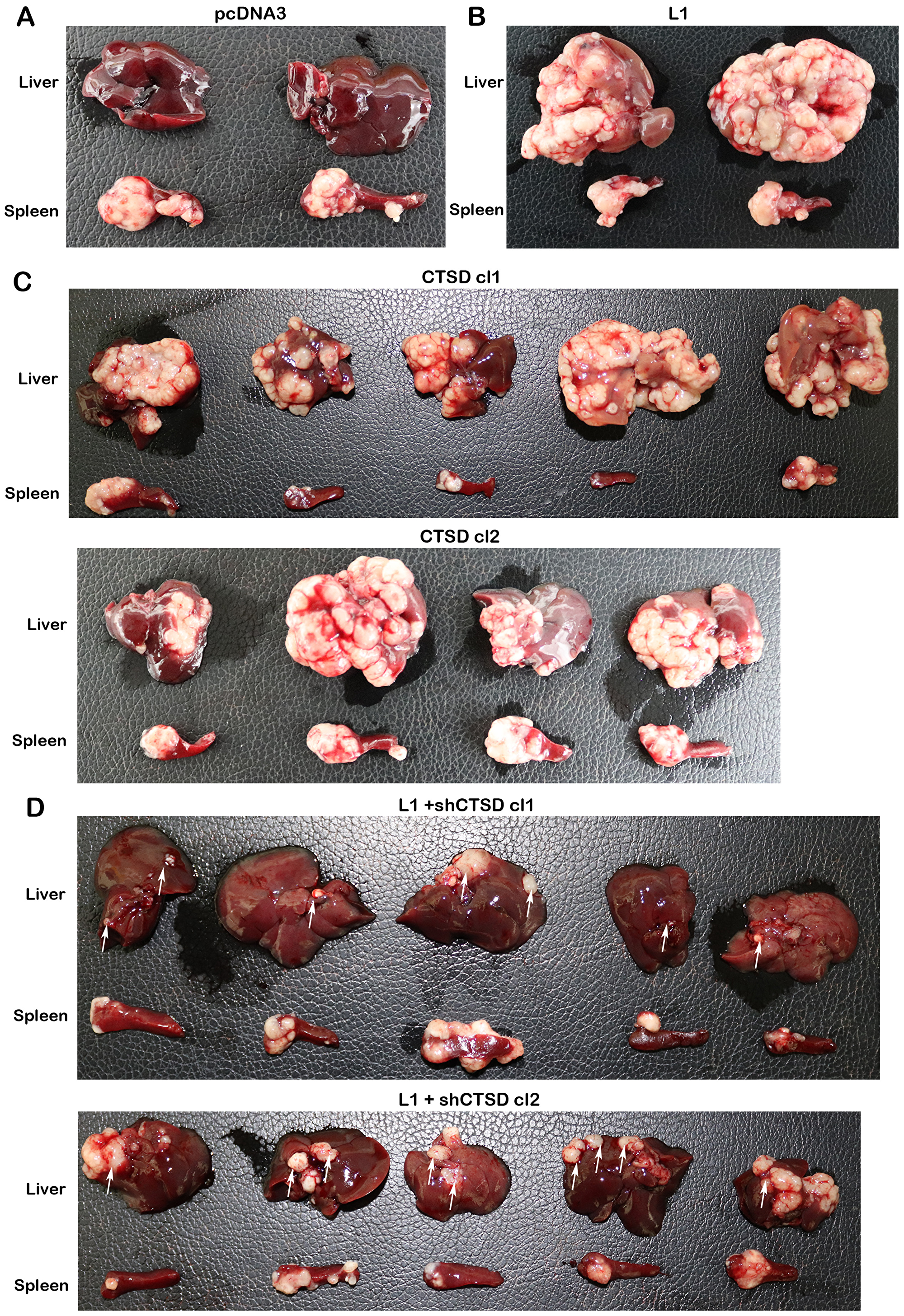CTSD expression levels affect the metastatic ability of human CRC cells to the liver.