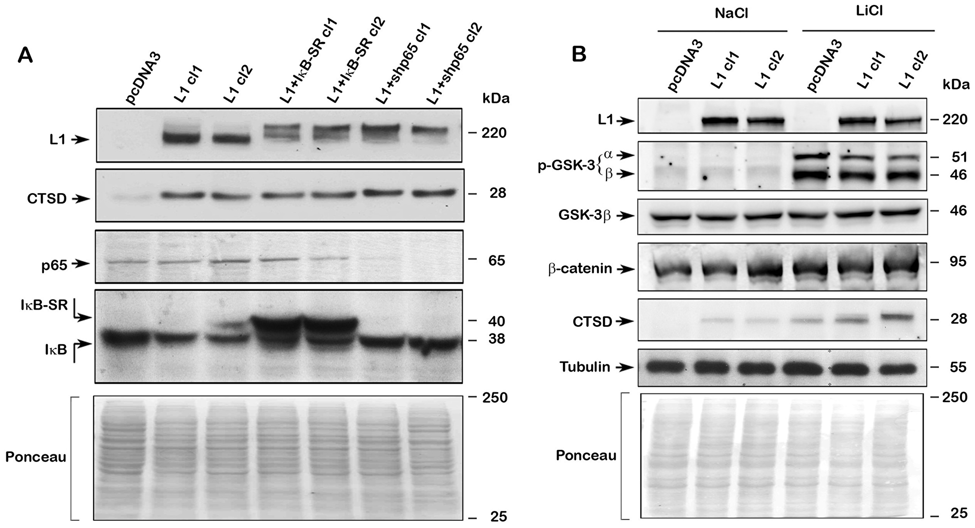 Regulation of CTSD expression by L1 does not involve NF-κB but is affected by Wnt/β-catenin signaling.