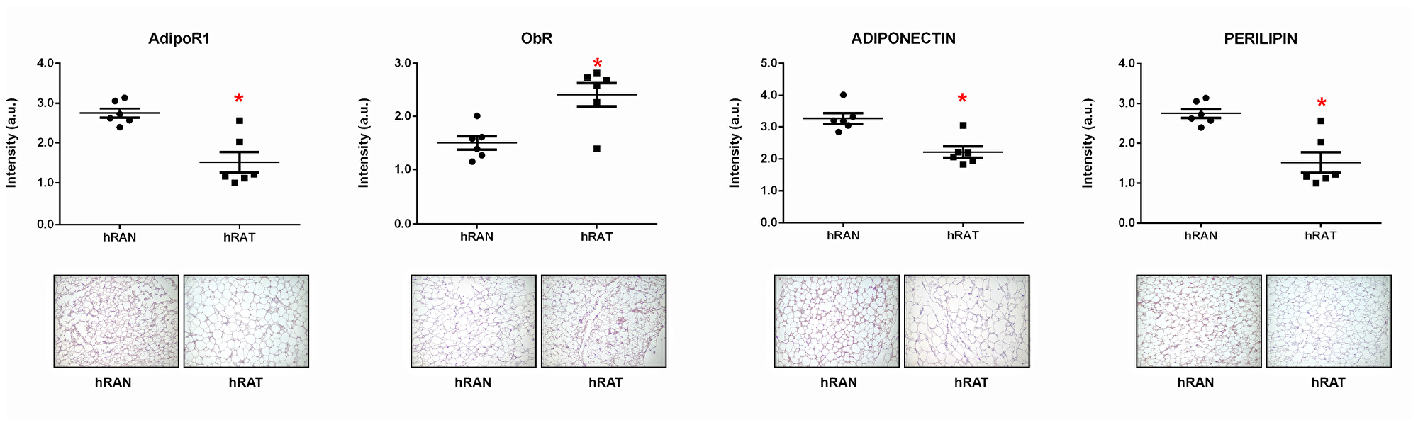 ObR, AdipoR1, adiponectin and perilipin 1 expression in the different adipose tissues.