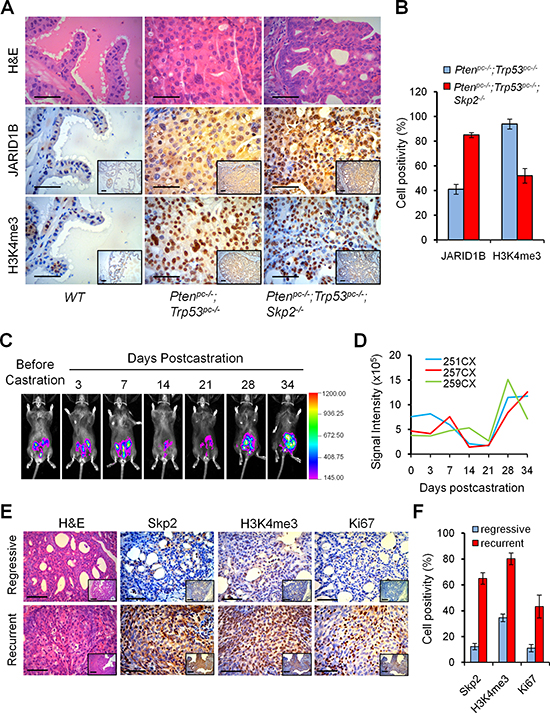 Skp2 inactivation decreases H3K4me3 to suppress prostate cancer progression in vivo, and H3K4me3 contributes to the recurrent growth of prostate tumors of Pten/Trp53 mice.