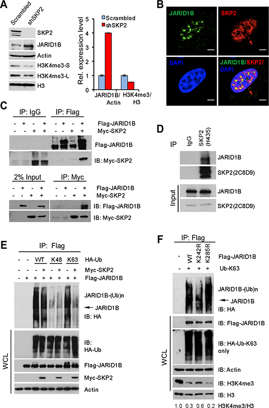 SKP2 suppresses K63-linked ubiquitination of JARID1B to elevate H3K4me3 in human prostate cancer cells.