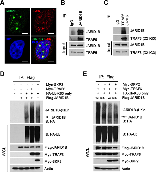 SKP2 regulates the ubiquitination of JARID1B through TRAF6.