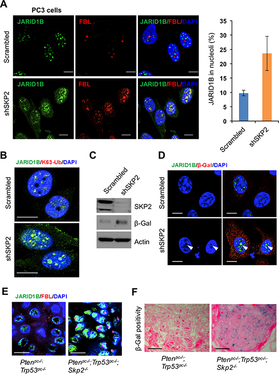 SKP2 inactivation induces an accumulation of ubiquitinated JARID1B in nucleolus of cells in vitro and in vivo for cellular senescence.