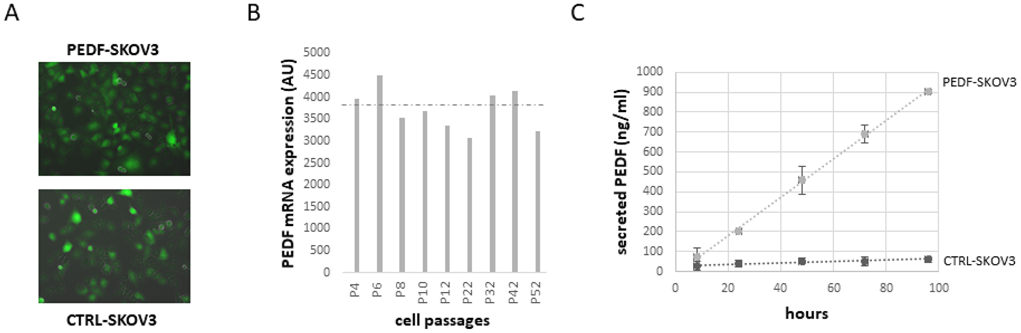 Expression of PEDF in SKOV3 cells stably transfected for PEDF with Sleeping Beauty Transposon (SBT) system.