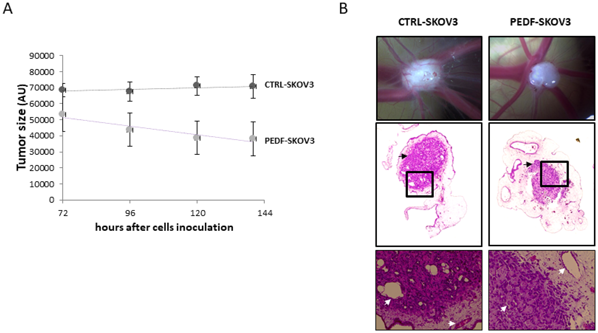 Tumorigenicity of PEDF-SKOV3 cells on CAM model.