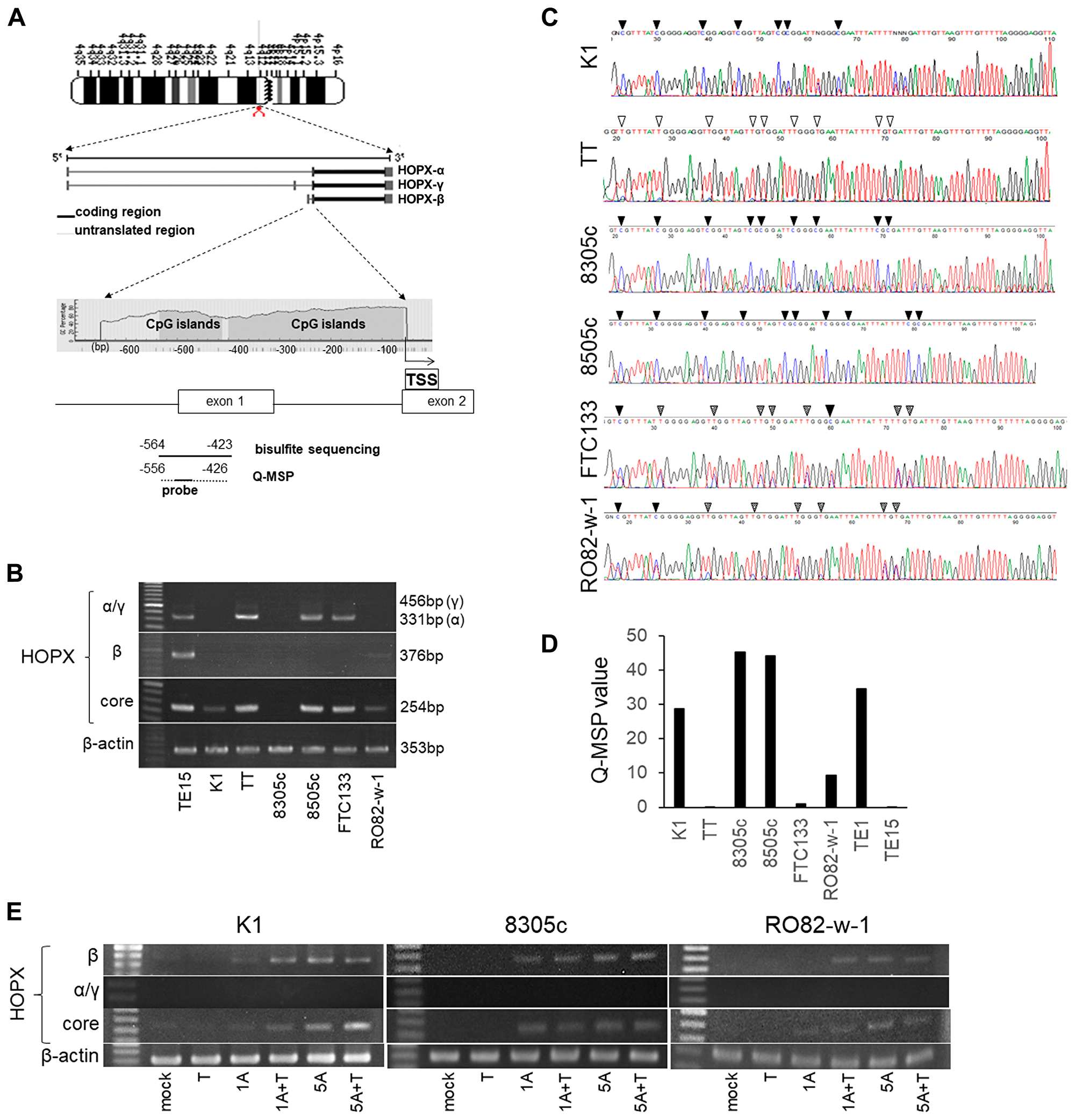 Analysis of promoter DNA methylation of HOPX and its expression in human papillary thyroid cancer (PTC) cell lines.