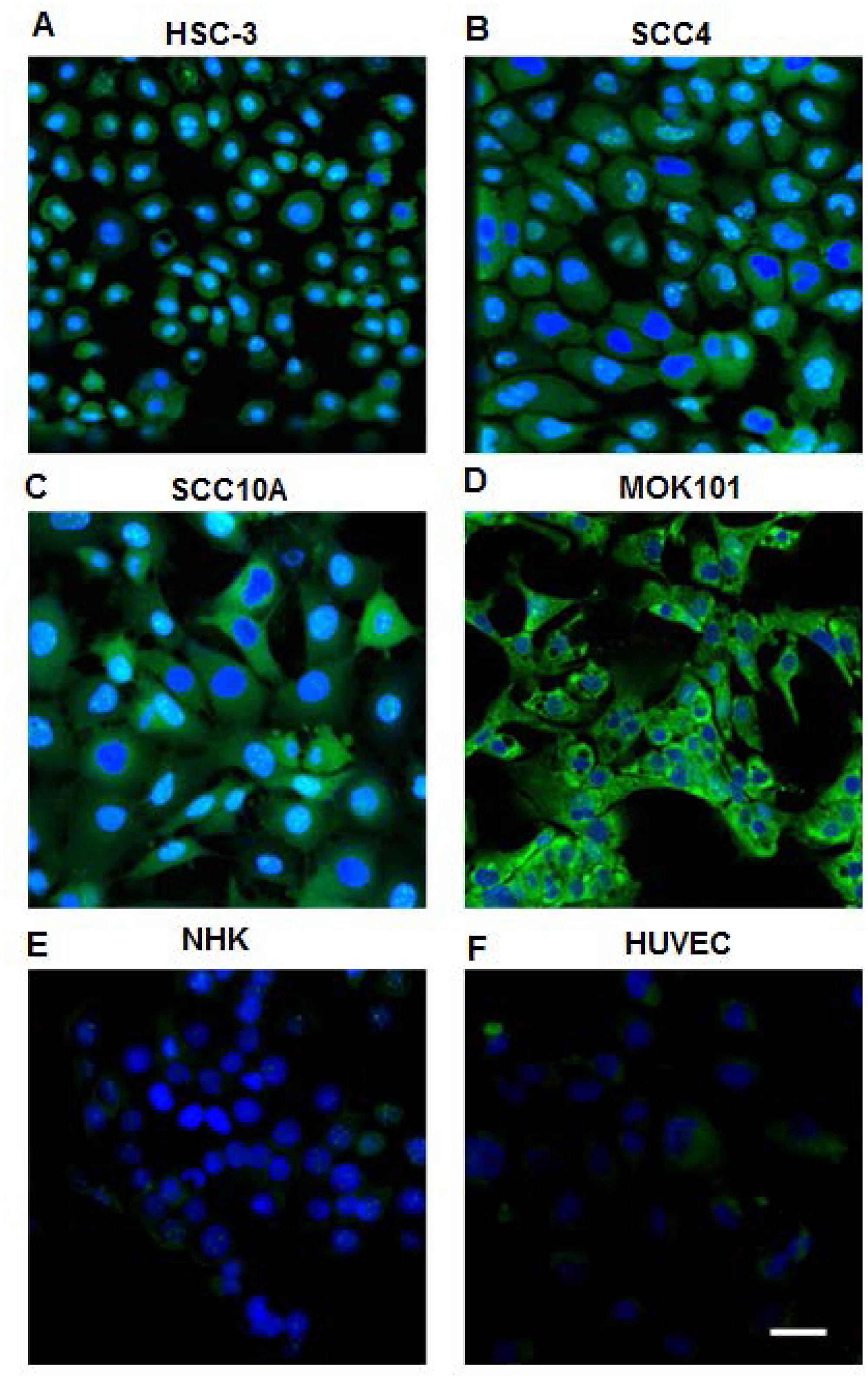 Confocal images of OSC cell lines and normal human cells stained by biotinylated LLY13/streptavidin-Alexa488.