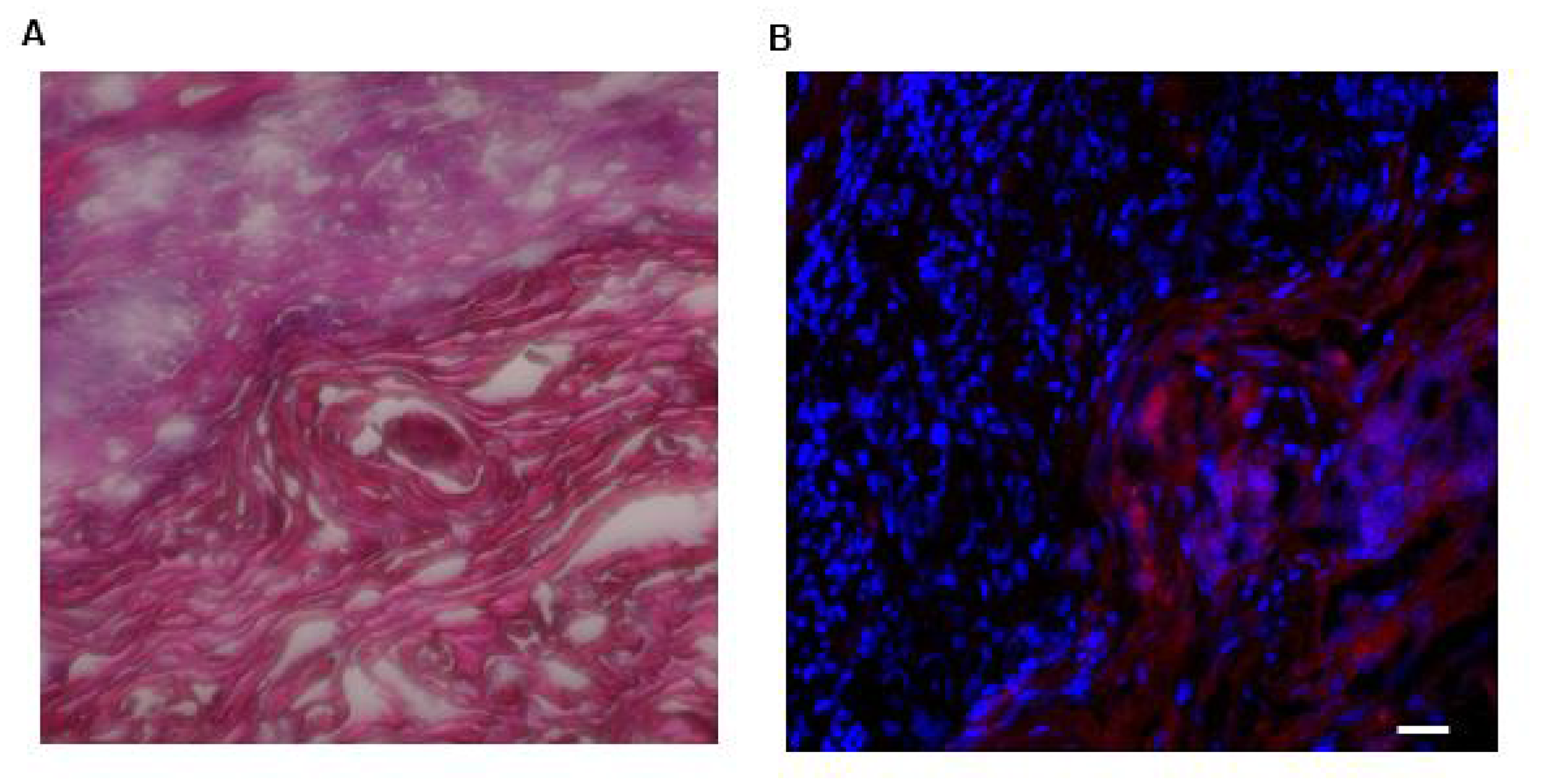 Photomicrographs of H&E staining of and LLY13-biotin/SA-Cy5.5 uptake into excised HSC3 implanted tongue tissues (20X).