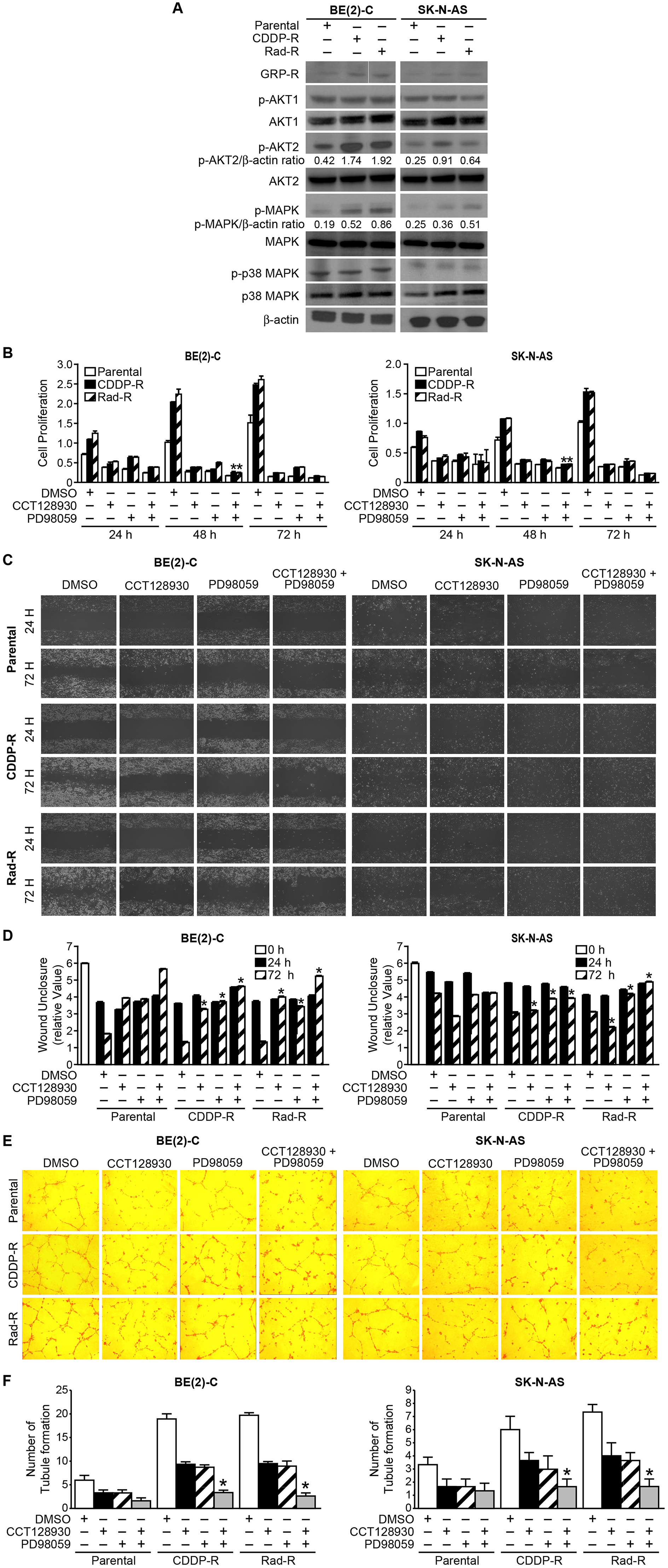 Activation of GRP-R/AKT2 and MAPK signaling pathways in CDDP-R/Rad-R BE(2)-C cells and CDDP-R/Rad-R SK-N-AS cells.