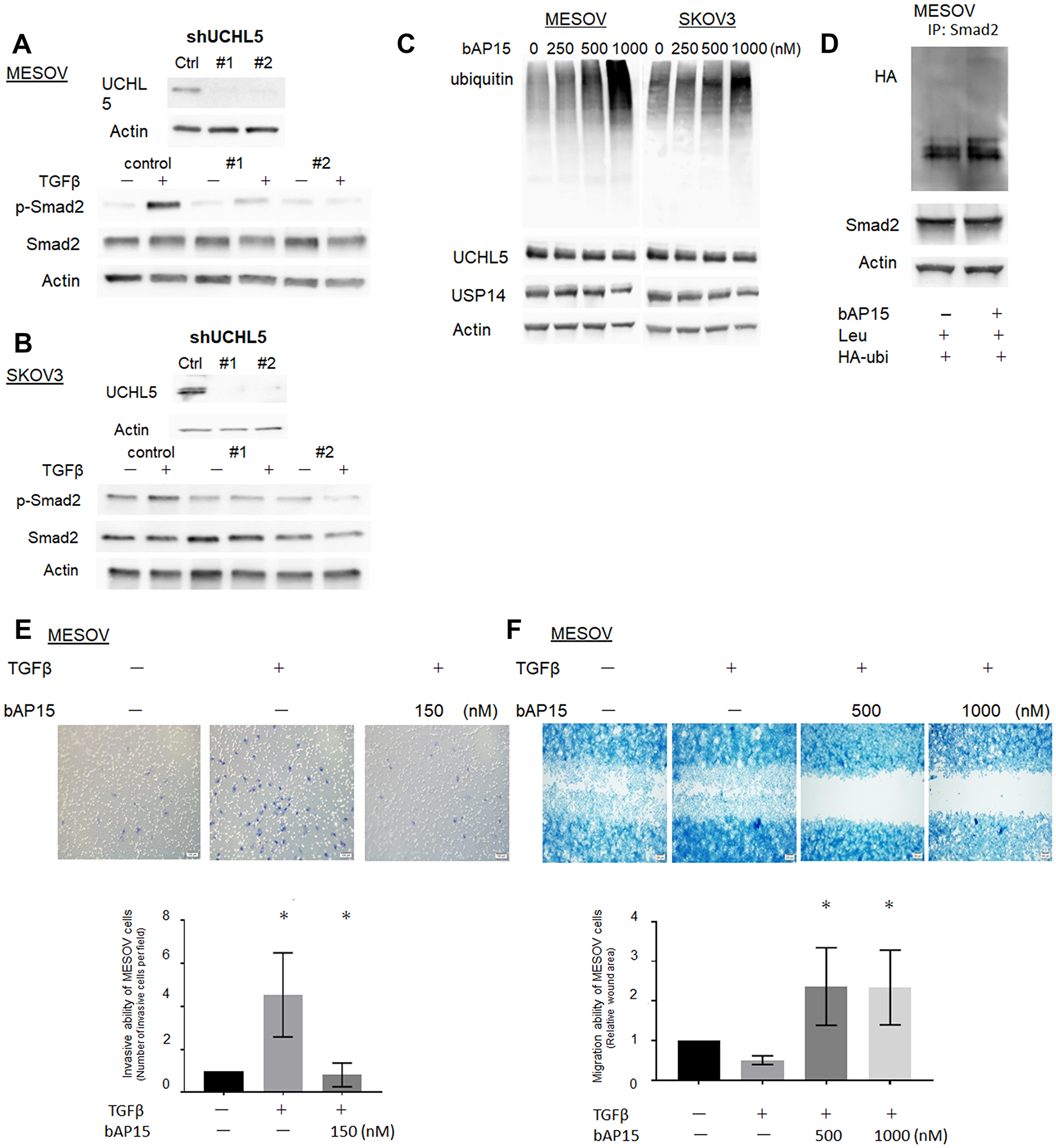 Knockdown of UCHL5 by shRNA suppresses phosphorylation of Smad2.