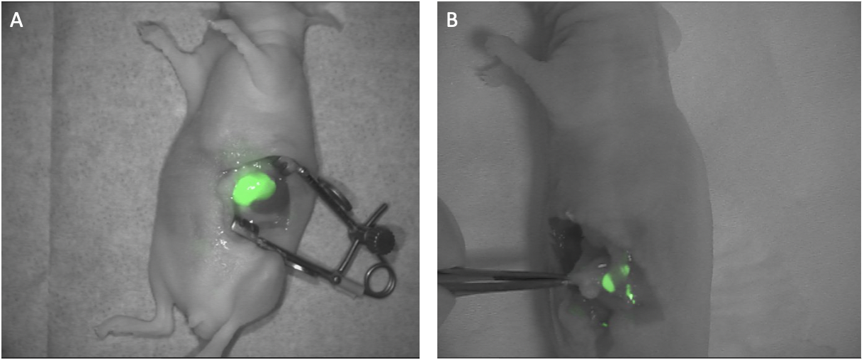 Fluorescent images of pancreatic tumors.