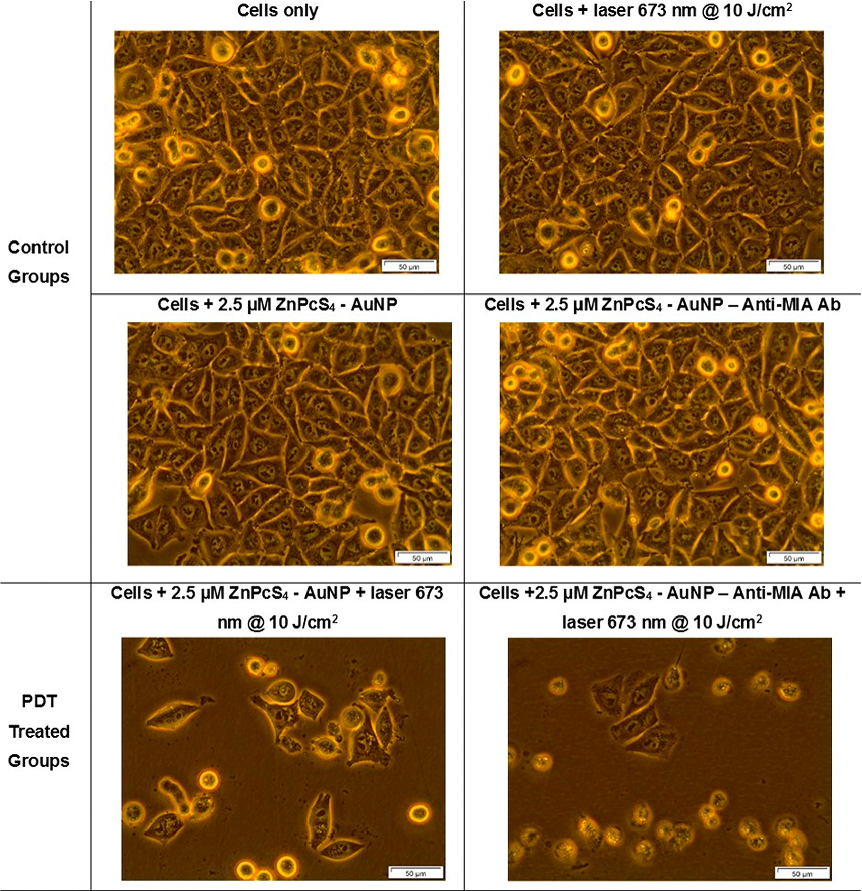 Light microscopy morphological images of MM cells at 400× magnification of control and experimental groups that were subjected to laser irradiation at a wavelength of 673 nm and a fluence of 10 J/cm2 during final PS drug conjugate PDT response assays.