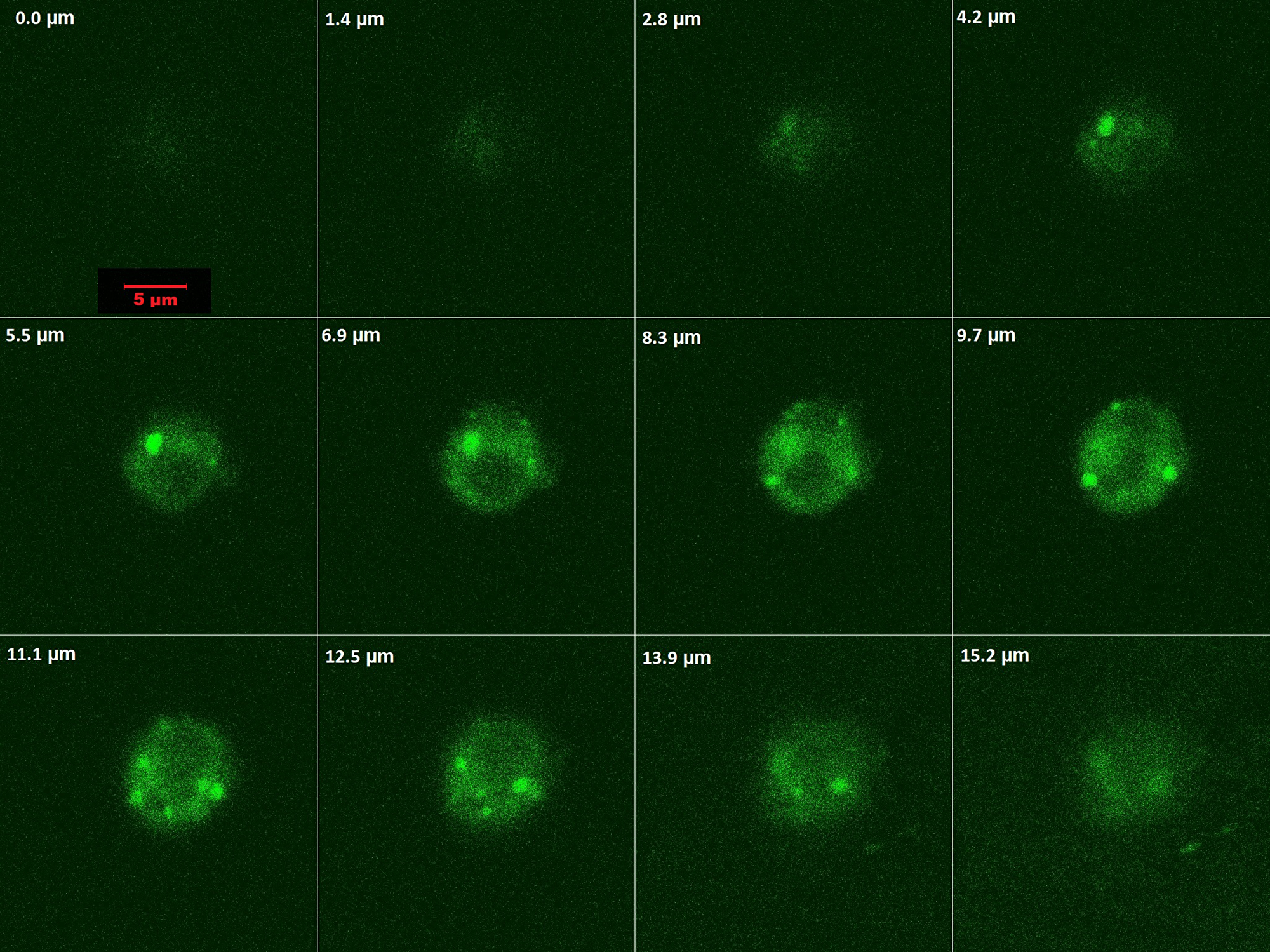 Optical slicing / Z-stacking by confocal microscopy showing intracellular localization and distribution of of PMPCalcein in HL 60 cells.