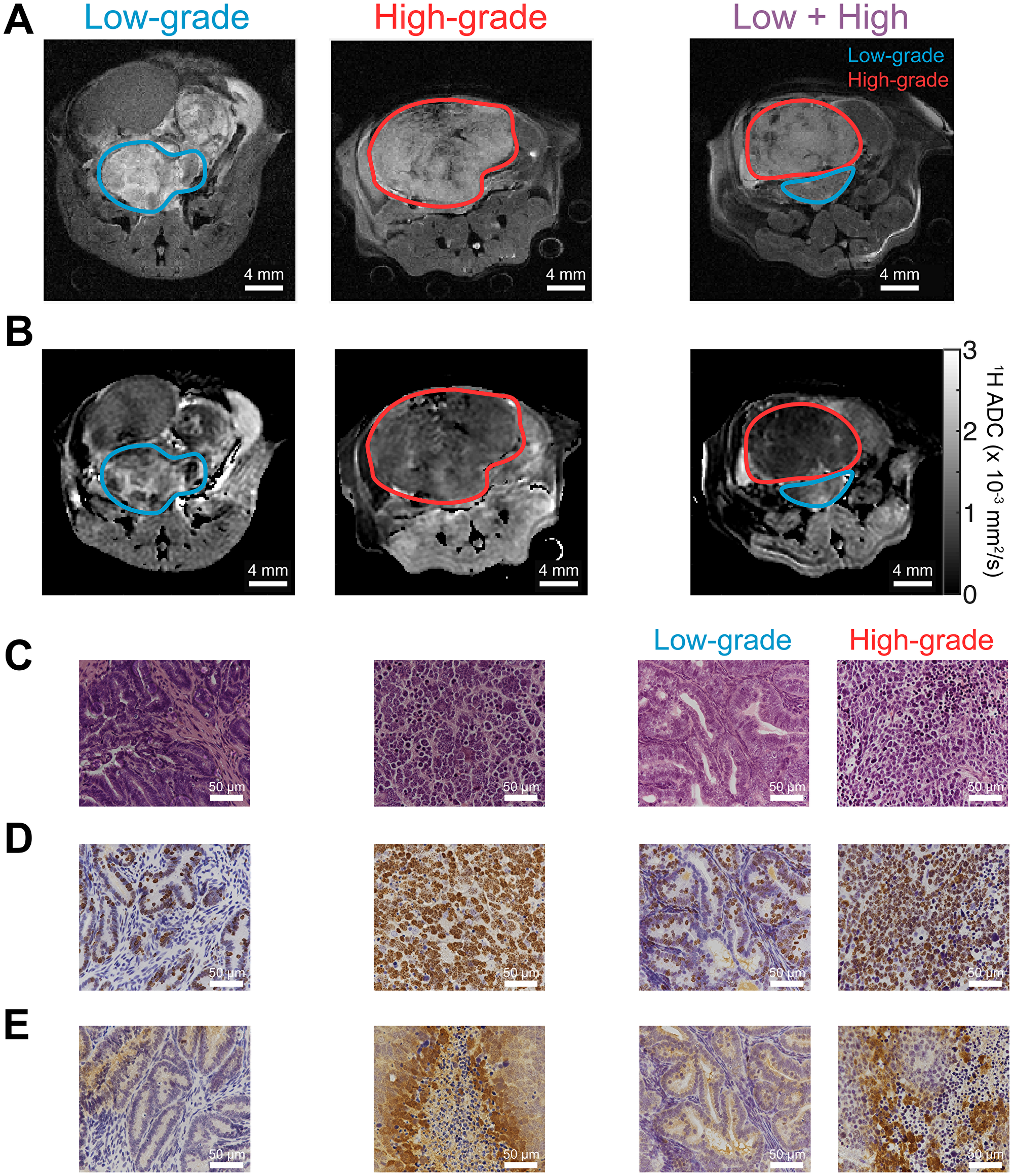 1H MR imaging and histological staining of TRAMP tumor tissue display differences in aggressive phenotype.