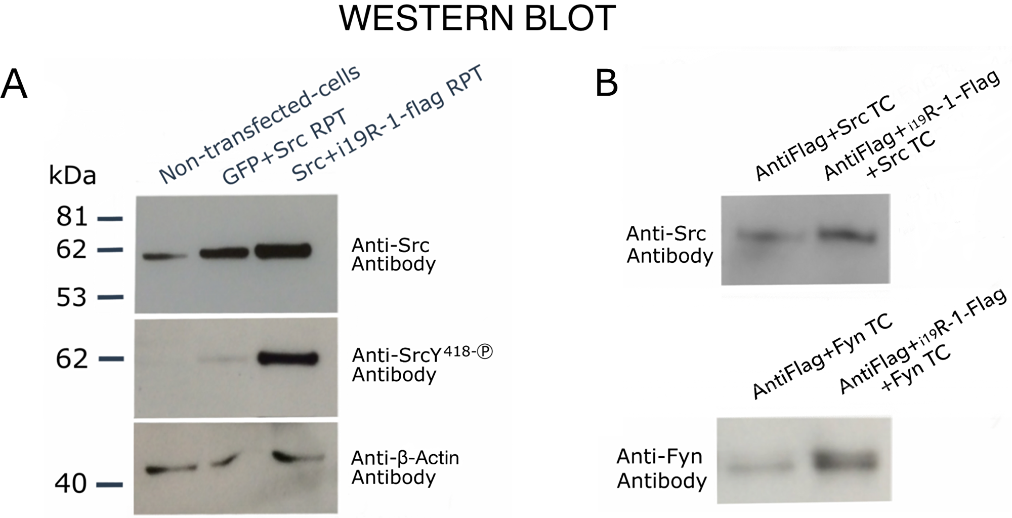Western blot analysis showing transphosphorylating activity and binding of i19VEGFR-1 on Src kinases.