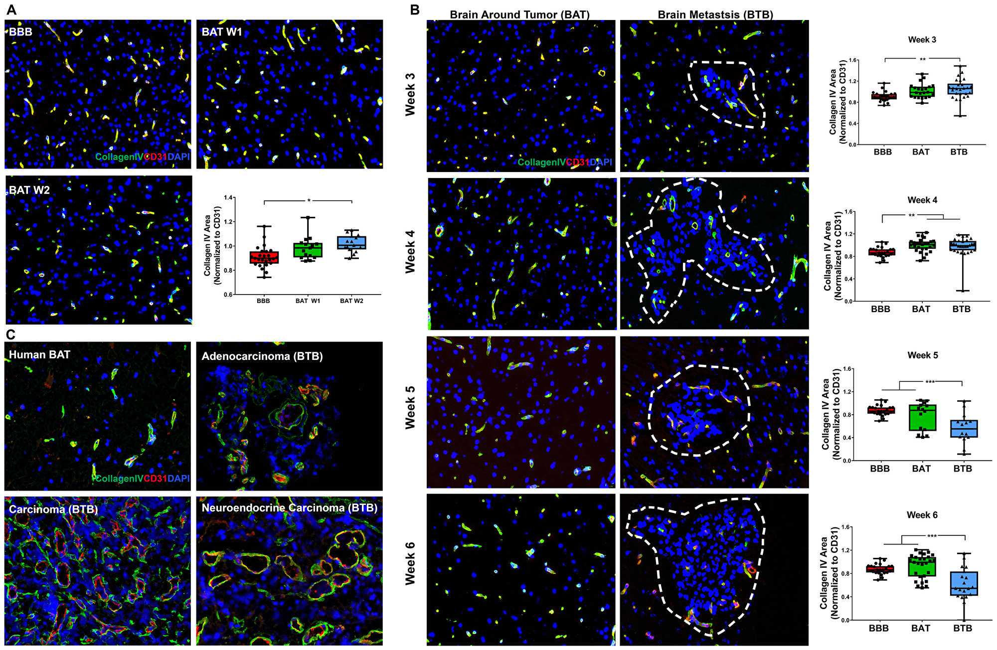 Collagen IV protein expression was diminished within late-stage NSCLC brain metastasis.