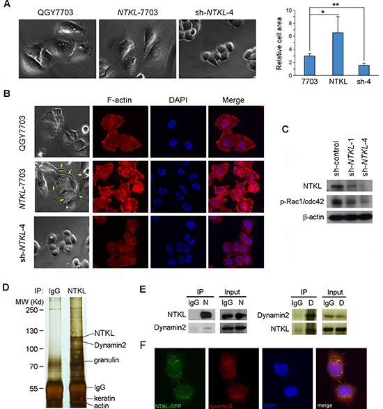 NTKL regulated the reorganization of actin cytoskeleton and interacted with dynamin2.