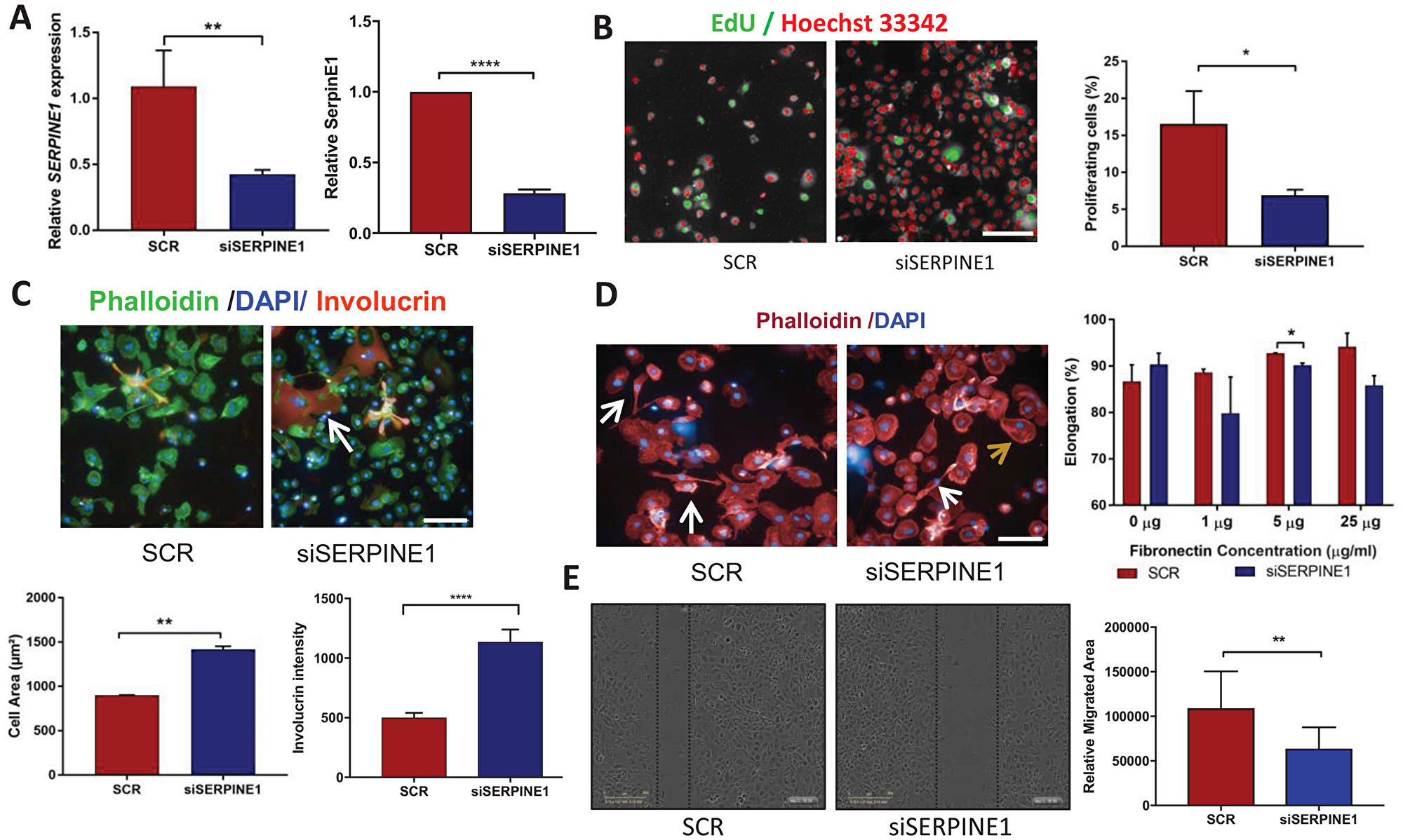 Cell phenotypes resulting from SERPINE1 knockdown.