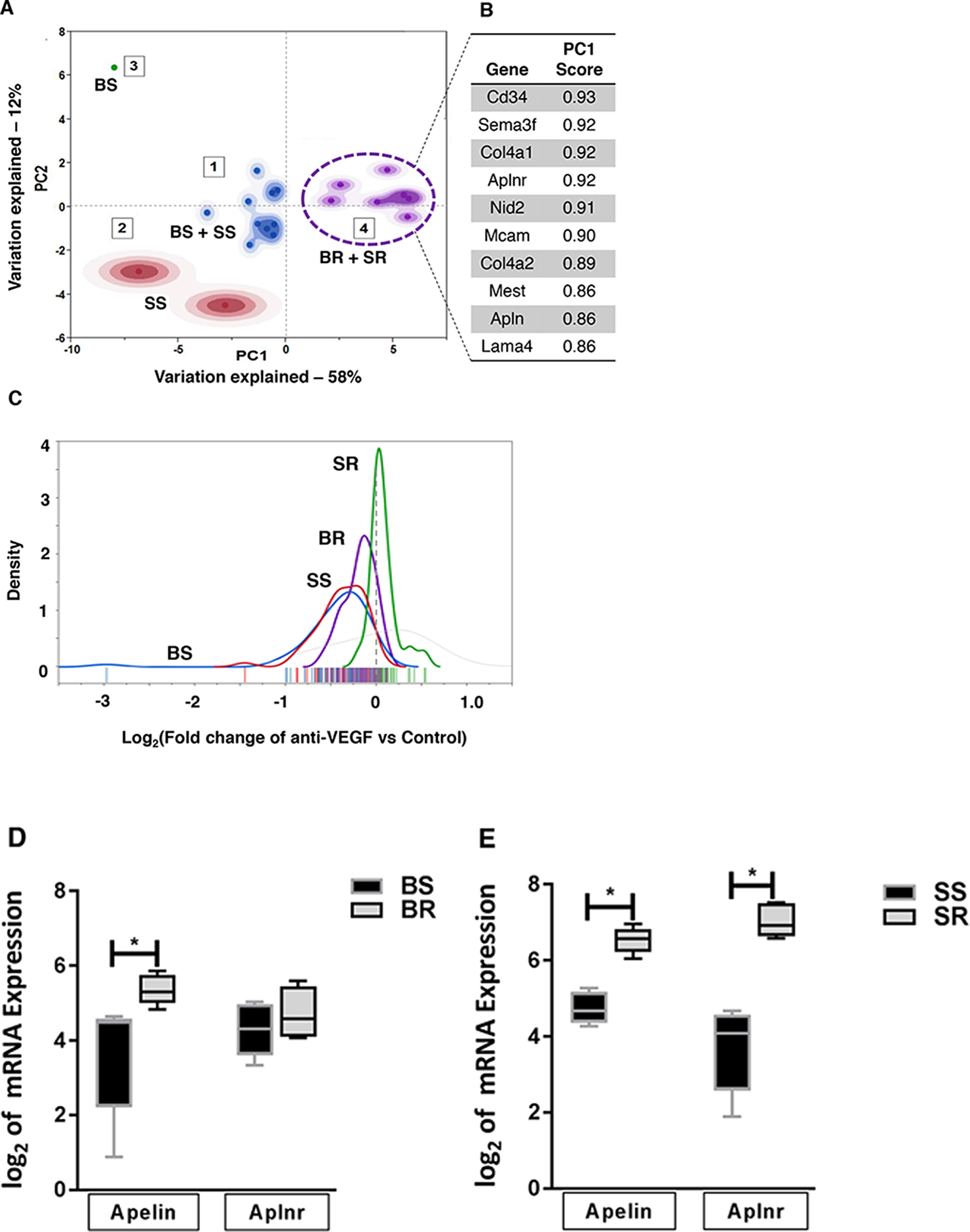 PCA analysis of stromal genes associated with resistant tumor phenotype.