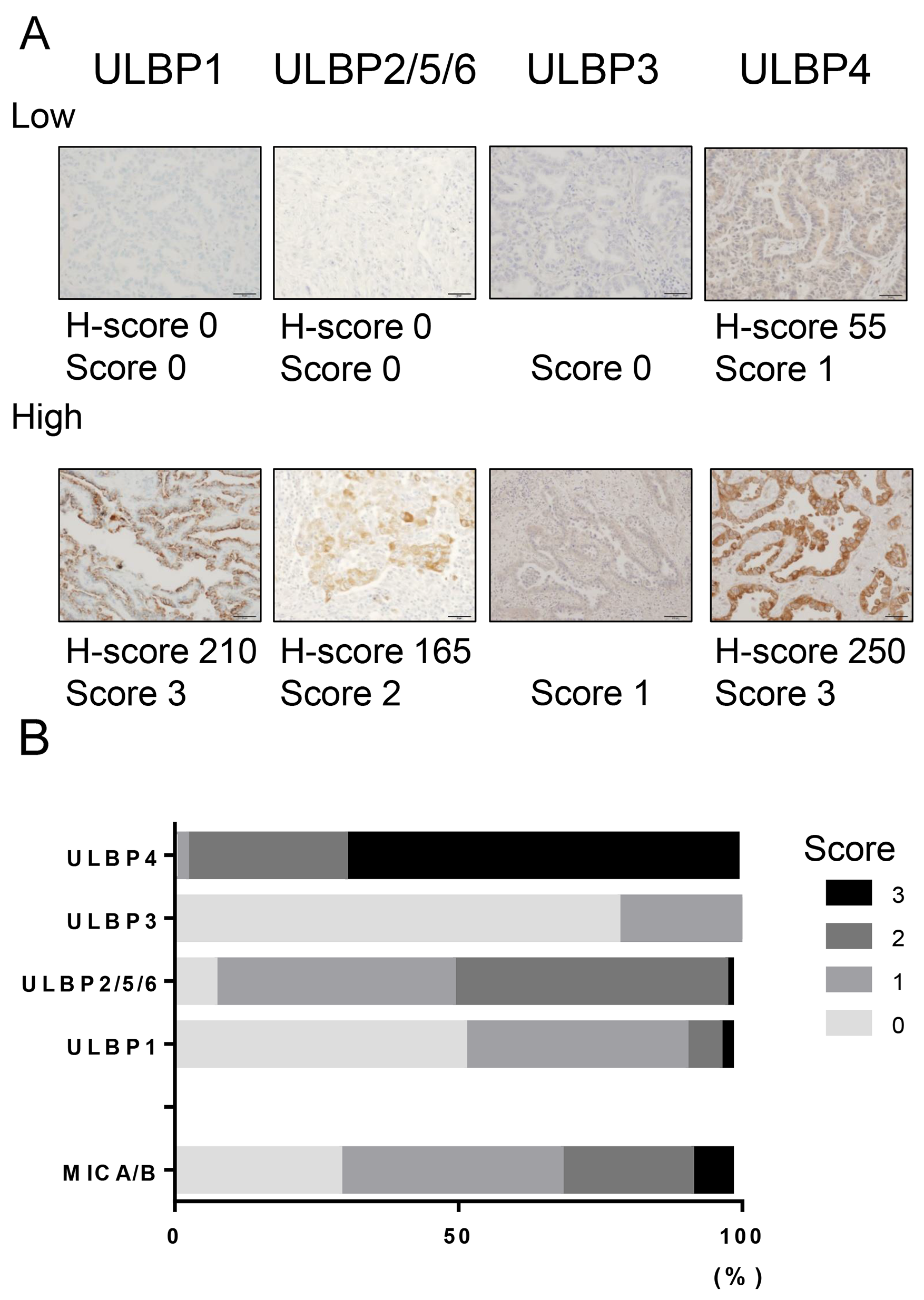 NKG2D ligand expression in NSCLC tissues.