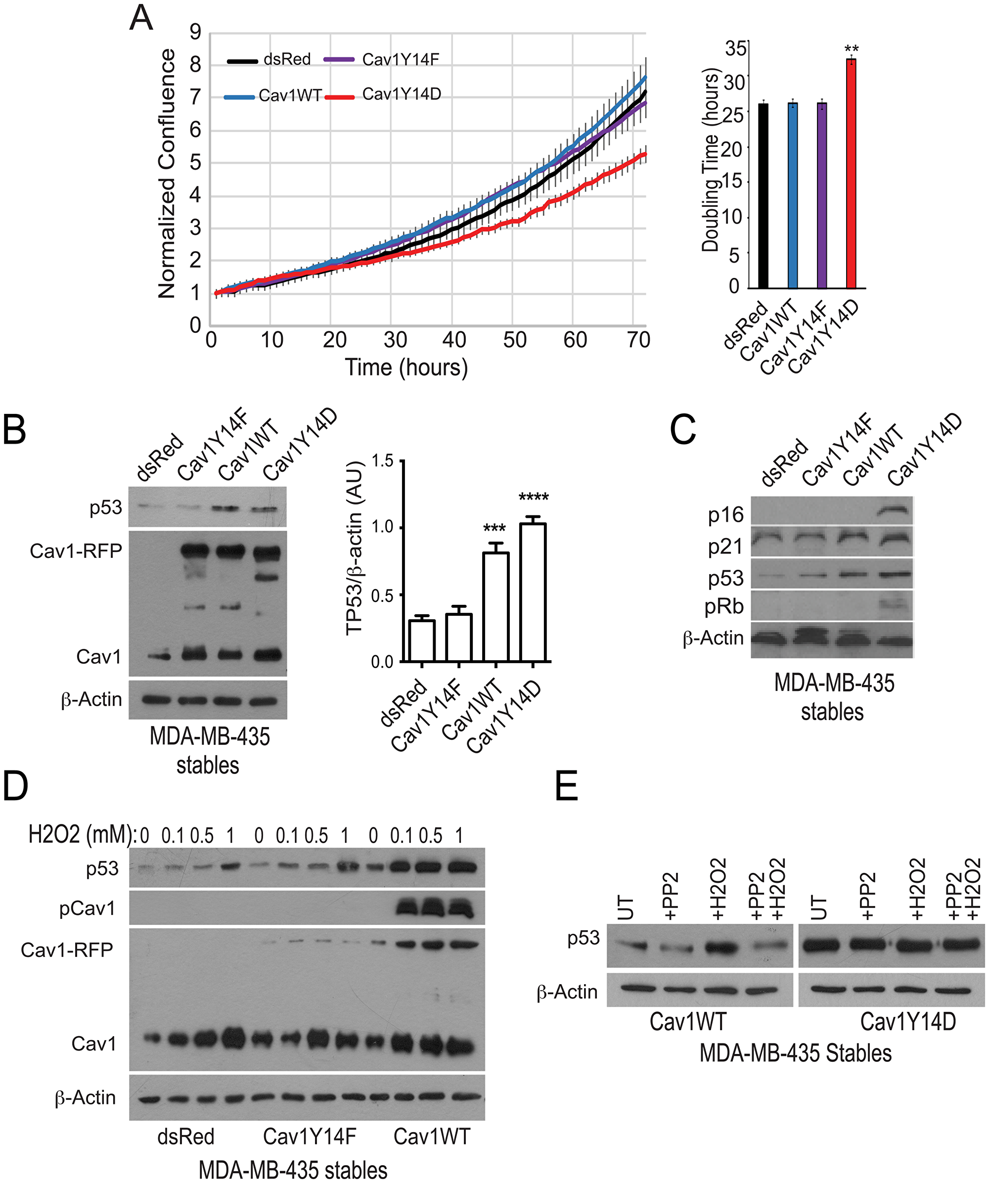 pCav1 restricts tumor cell proliferation and promotes TP53 expression.