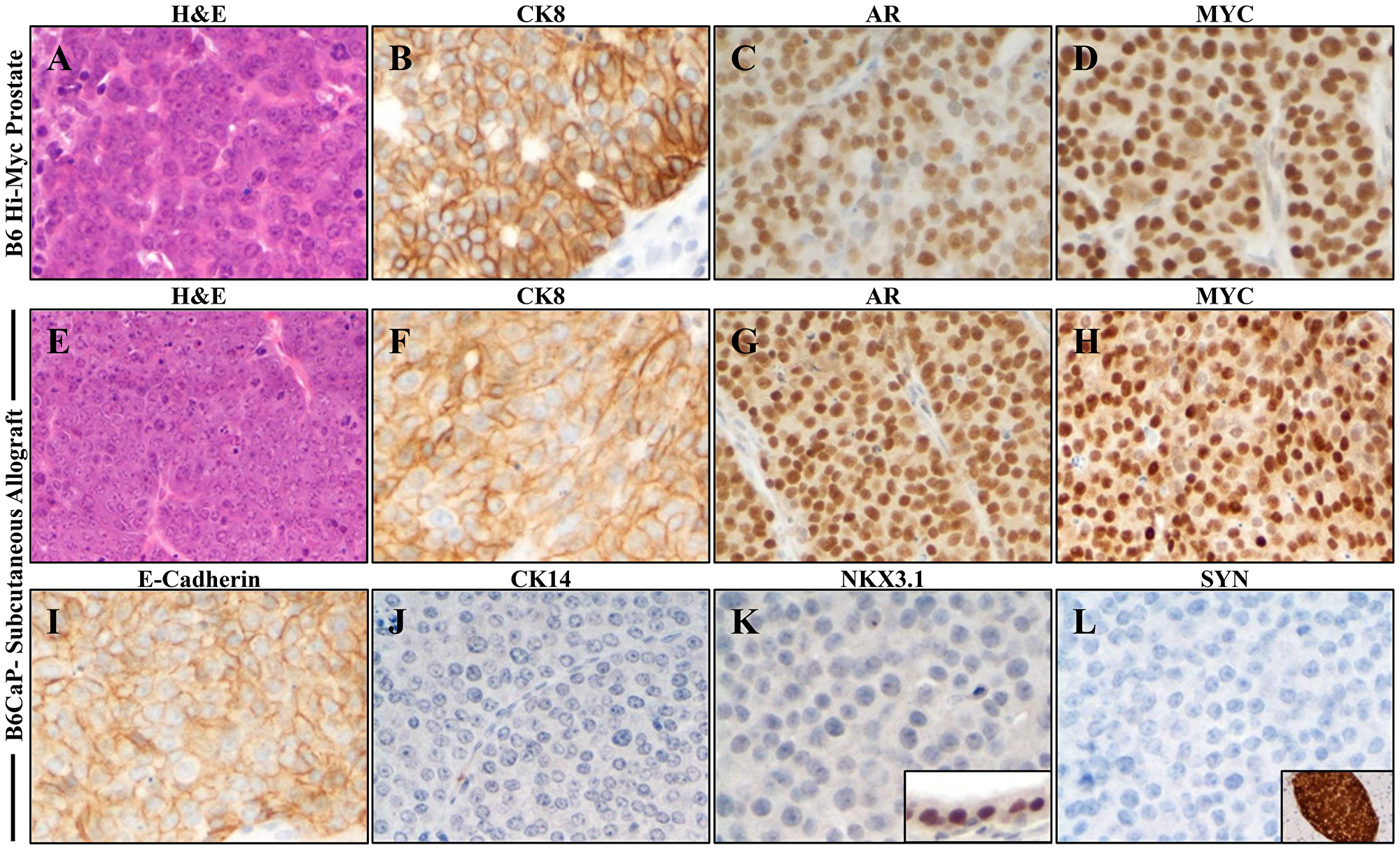 B6CaP allograft recapitulates luminal epithelial phenotype of autochthonous Myc-driven prostate cancer.