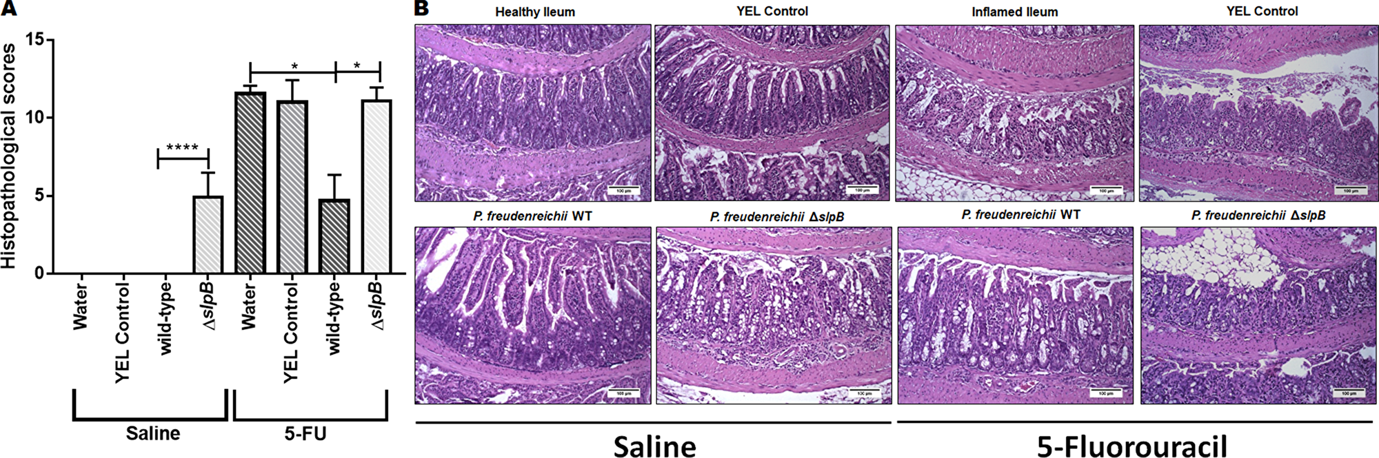 Propionibacterium freudenreichii WT strain alleviates mucosal damage in the ileum of 5-FU-treated mice while mutant strain P. freudenreichii &Delta;slpB causes inflammation in healthy mice.