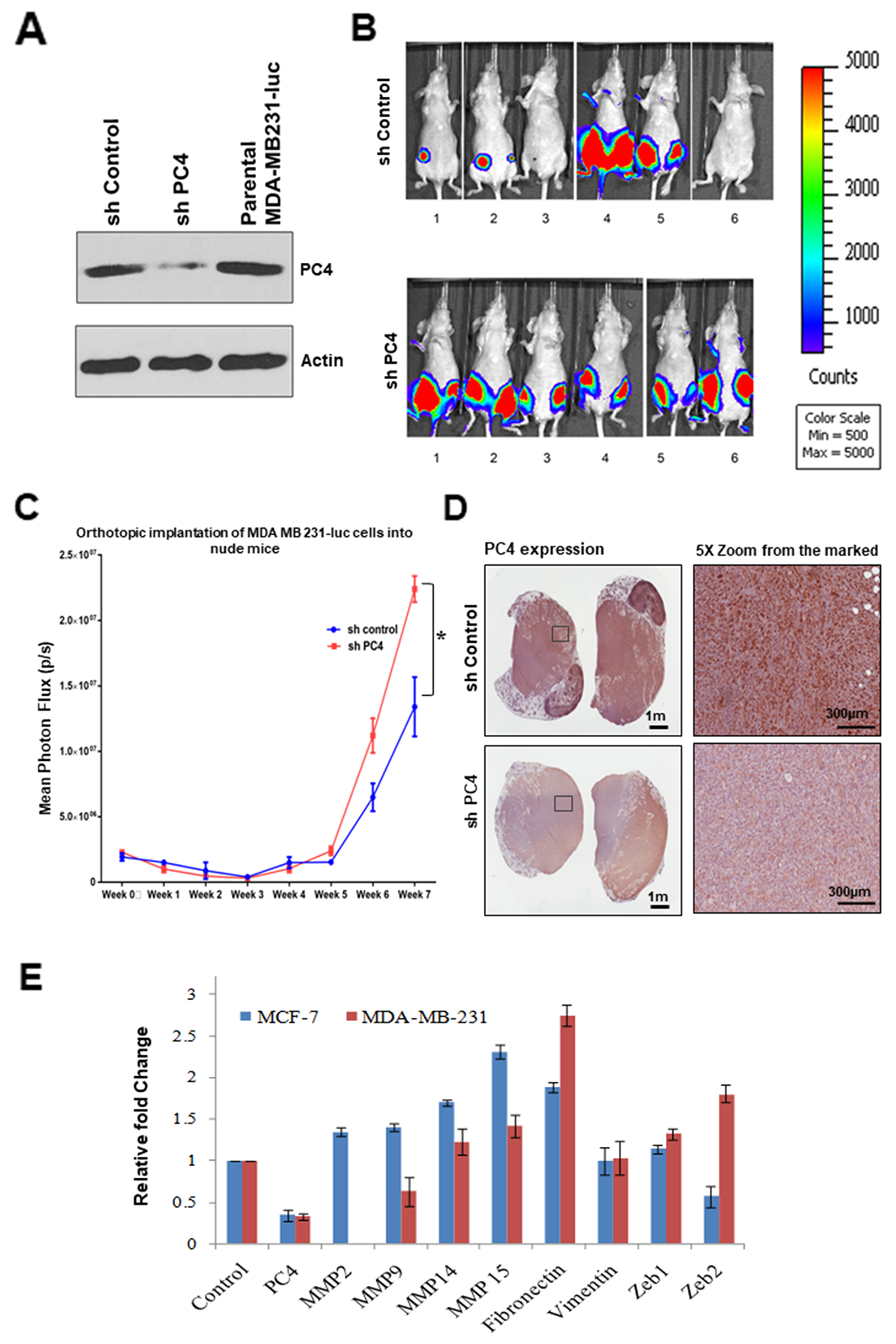 Downregulation of PC4 suppresses tumour progression in orthotopic breast cancer mice-model.