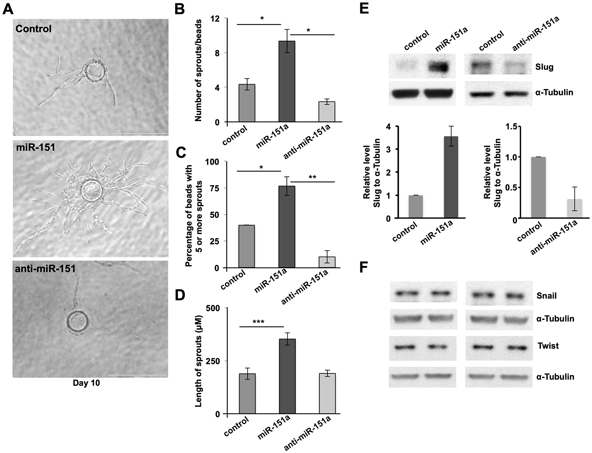 miR-151a enhances EC angiogenesis and induces the amount of Slug protein.
