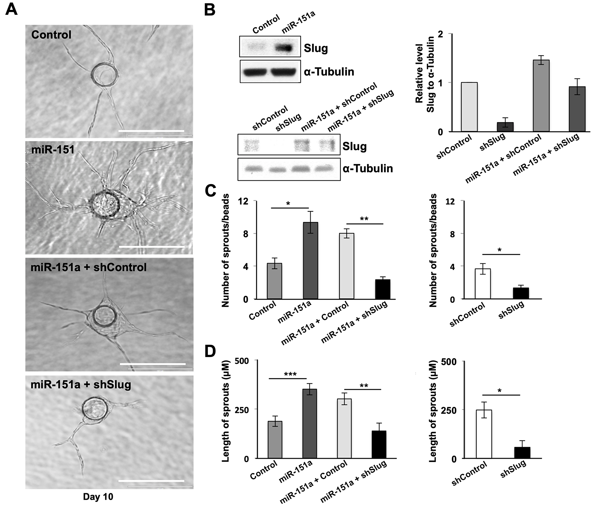 miR-151a enhanced EC angiogenesis is dependent on Slug induction.