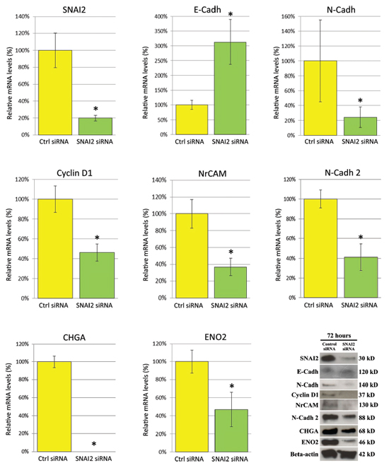 Effects of SNAI2-siRNA on the expression of genes associated to EMT, cell cycle, cell adhesion and neuroendocrine differentiation in PC3 cells, as assessed by real-time RT-PCR and Western Blot analysis.