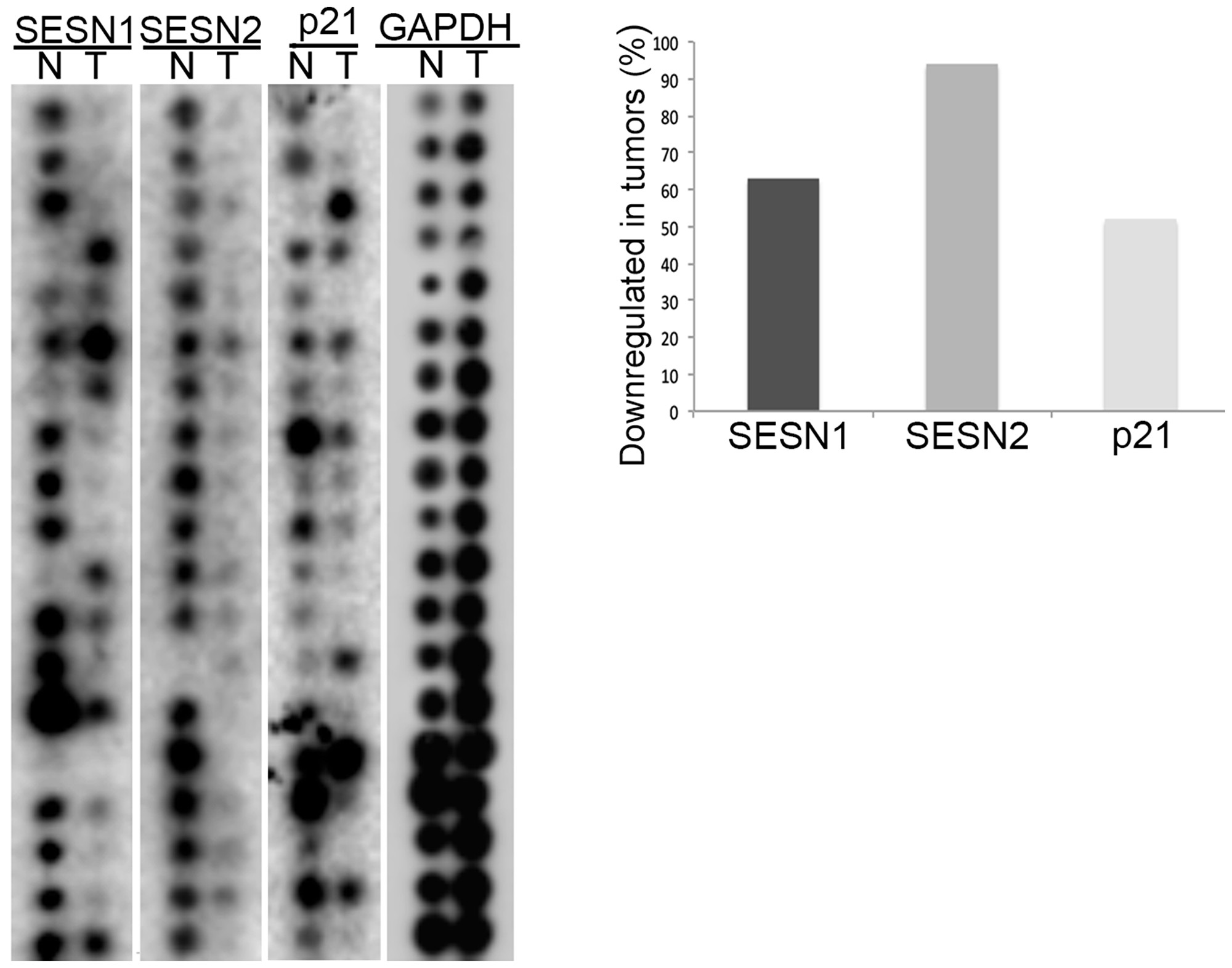 The expression of SESN1 and SESN2 genes is decreased in human lung tumors.