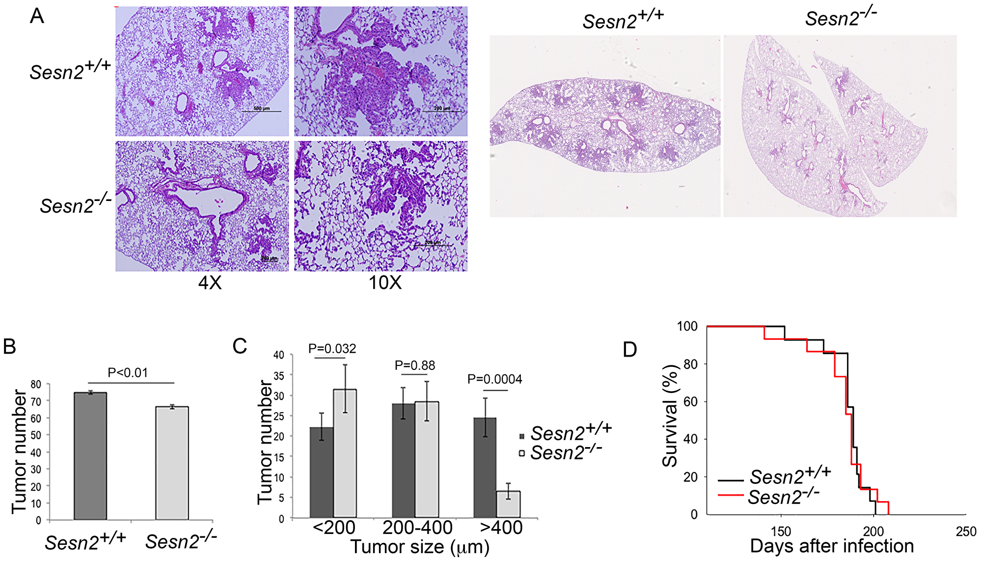 Sesn2 inactivation does not affect tumor initiation and life expectancy in tumor-bearing mice but slows down tumor growth.