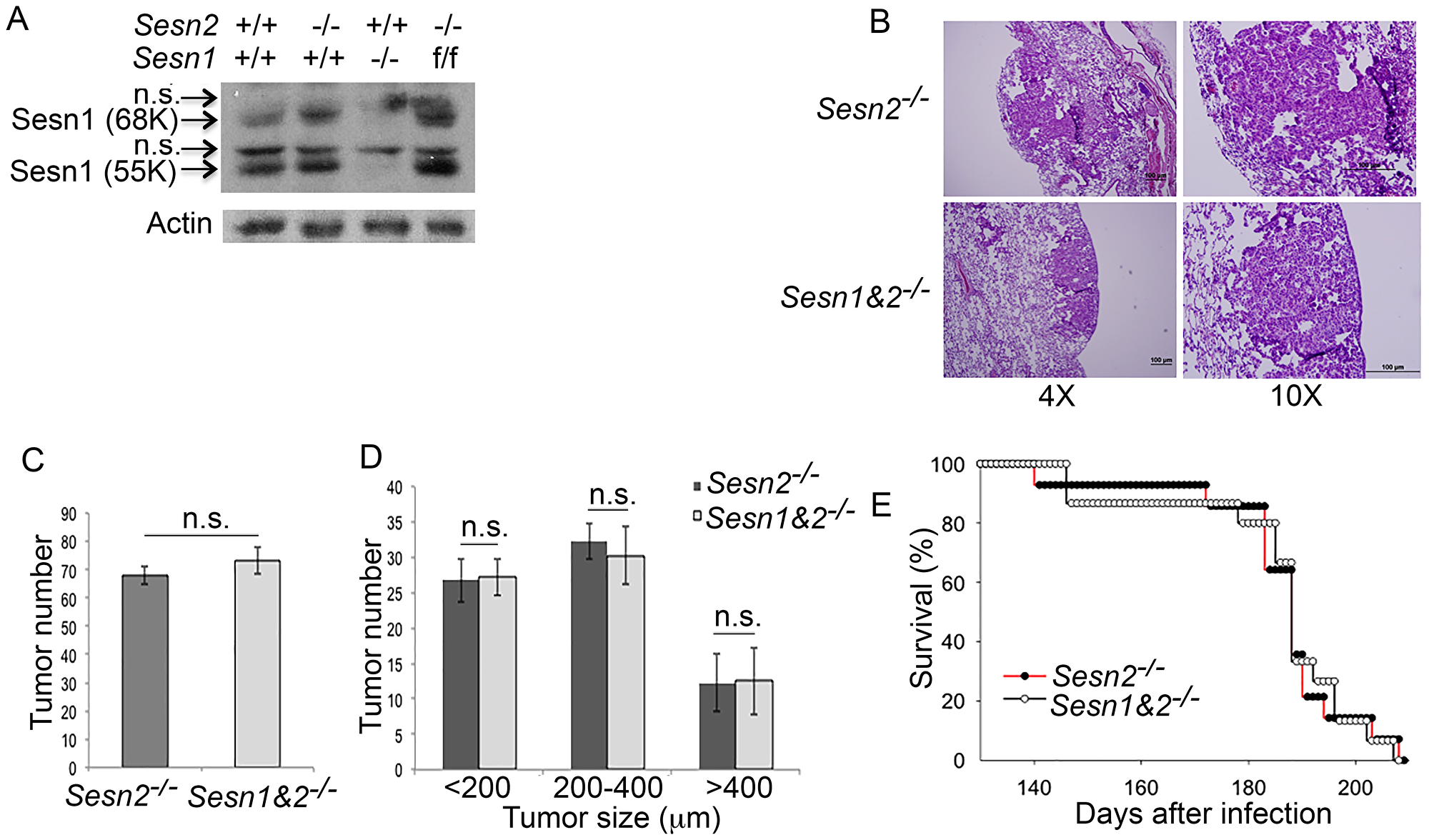 Inactivation of Sesn1 in Sesn2-/-;KrasLSL-G12D mice does not affect tumor phenotype.