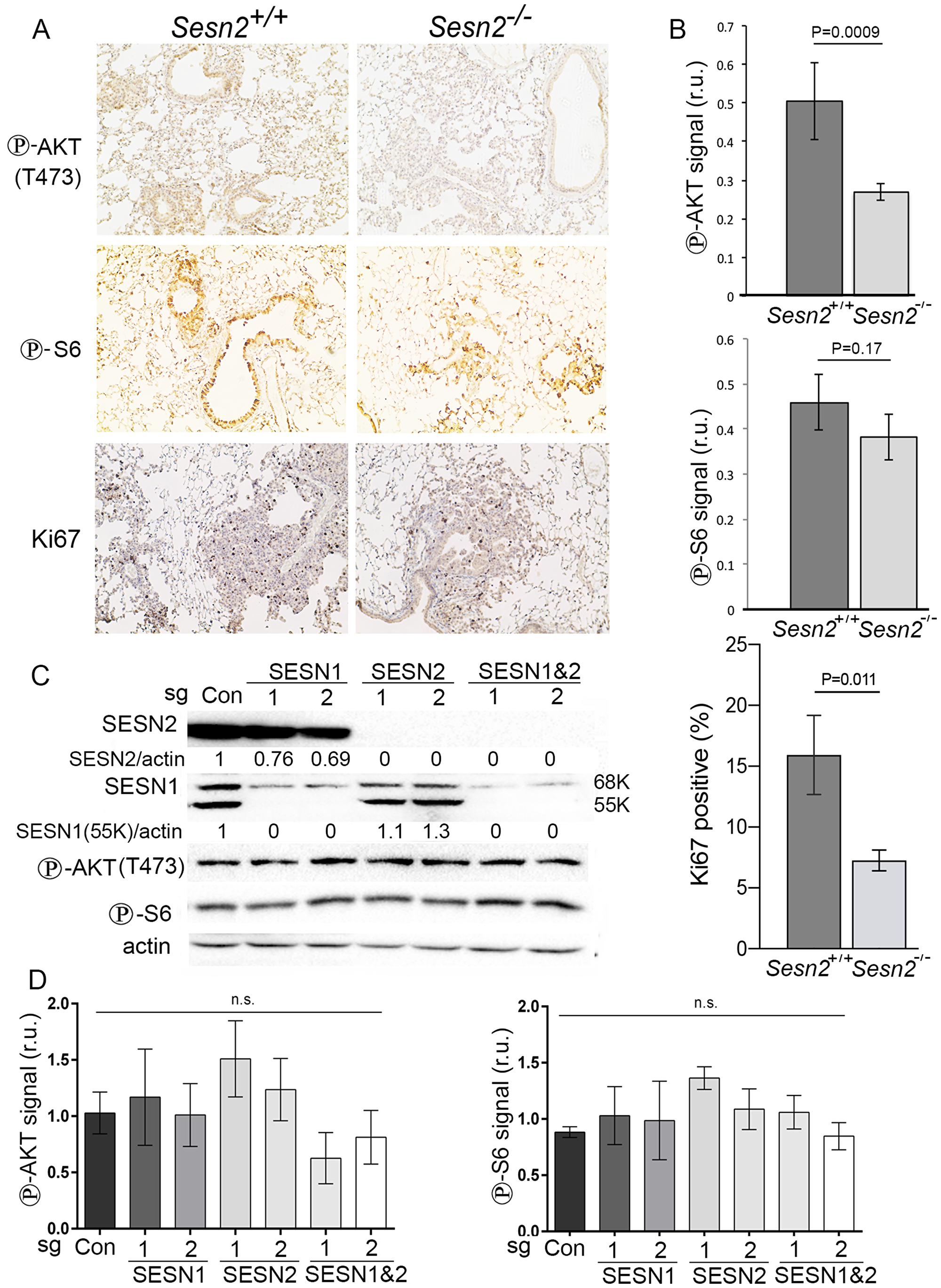 Inactivation of Sesn2 diminishes phosphorylation of AKT.